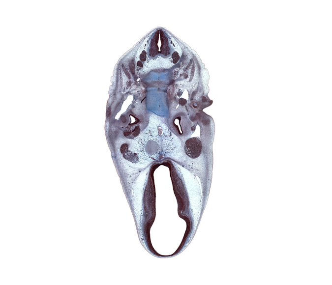 C-1 vertebra (atlas), C-2 / C-3 intervertebral disc, C-3 spinal ganglion, C-3 ventral primary ramus, abducens nerve (CN VI), atlanto-axial joint, auricle, basi-occipital (basal plate), basilar artery, central canal, centrum of C-2 vertebra (axis), descending part of facial nerve (CN VII), dural band for tentorium cerebelli, edge of pons region (metencephalon), geniculate ganglion (CN VII), hypothalamus, inferior ganglion of glossopharyngeal nerve (CN IX), marginal ridge, neural arch of C-2 vertebra (axis), notochord, oculomotor nerve (CN III), osteogenic layer, subarachnoid space, trigeminal ganglion (CN V), trochlear nerve (CN IV), ventral thalamus, zona limitans intrathalamica