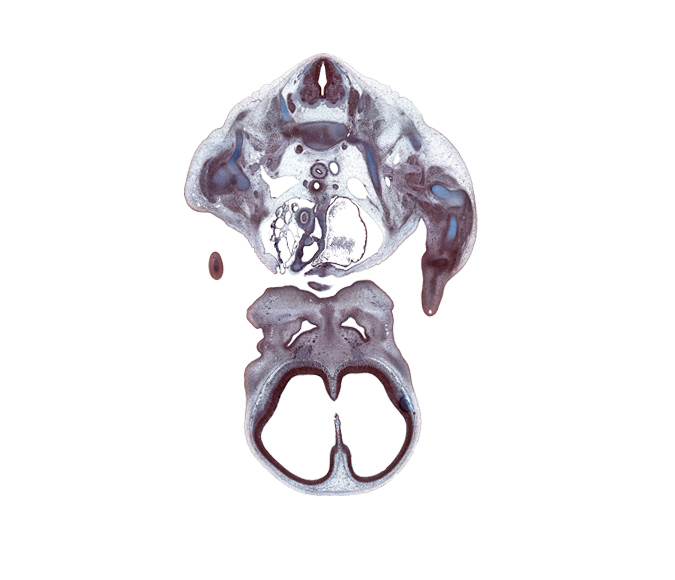 C-7 / T-1 intervertebral disc, T-1 intercostal nerve, T-1 spinal ganglion, T-1 spinal nerve, artifact(s), ascending aorta, centrum of T-1 vertebra, cerebral vesicle (telencephalon), edge of chin, edge of interventricular foramen, frontal prominence, hippocampus, humerus, infundibulum of right ventricle, lamina terminalis, lateral ventricle, left atrium, left pulmonary artery, maxillary prominence of pharyngeal arch 1, olfactory filia (CN I), olfactory placode, pericardial cavity, primary palate, pulmonary semilunar valve, pulmonary trunk, right subclavian artery, right subclavian vein, scapula, shaft of rib 1, superior vena cava, sympathetic trunk, vagus nerve (CN X)