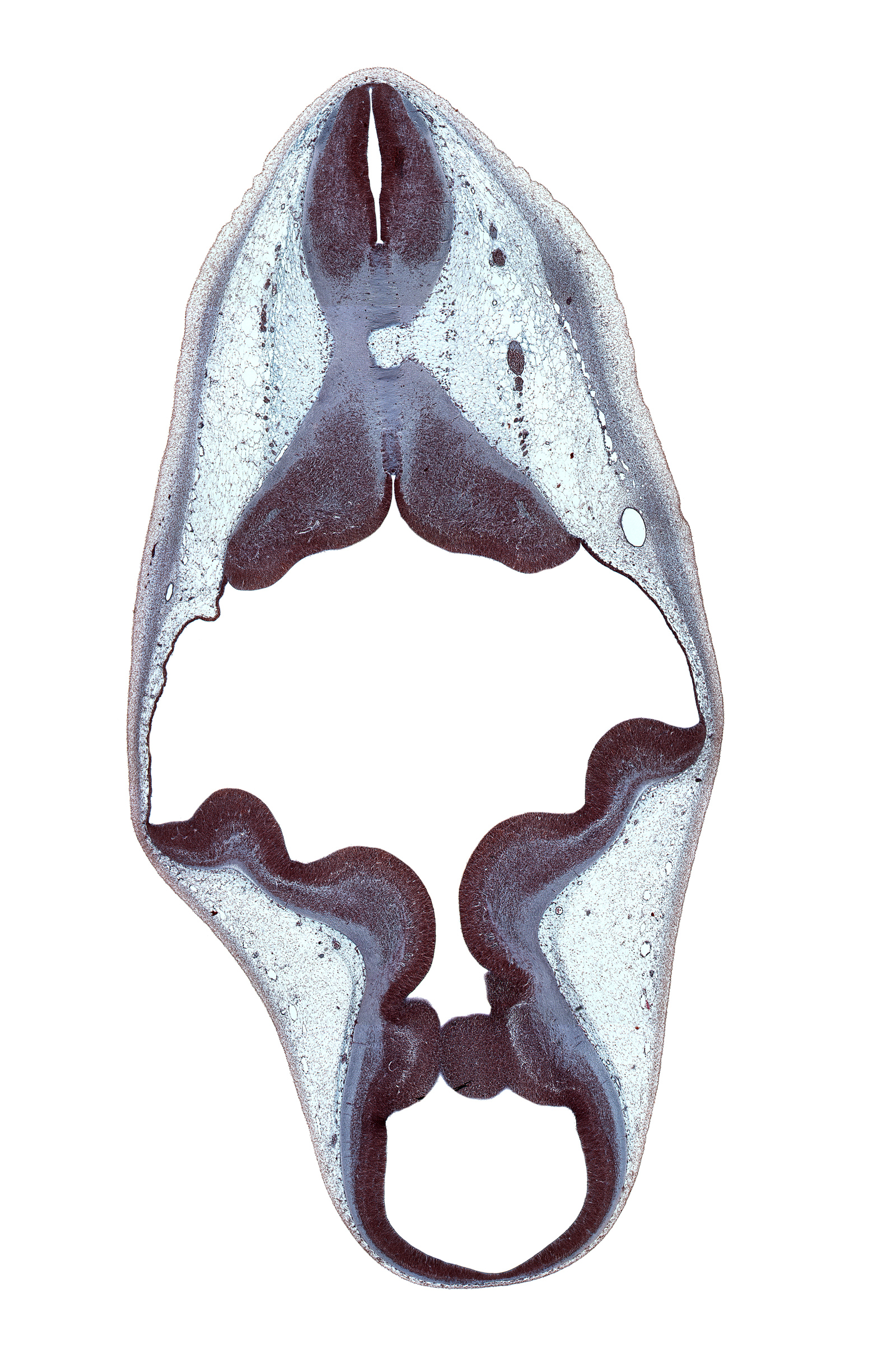 accessory nerve (CN XI), cerebral aqueduct (mesocoele), decussation, endolymphatic sac, floor plate of mesencephalon, isthmus of rhombencephalon, myelencephalon, osteogenic layer, rhombencoel (fourth ventricle), roof of rhombencoel (fourth ventricle), roof plate of mesencephalon, root of vagus nerve (CN X), sulcus limitans, trochlear nerve (CN IV)