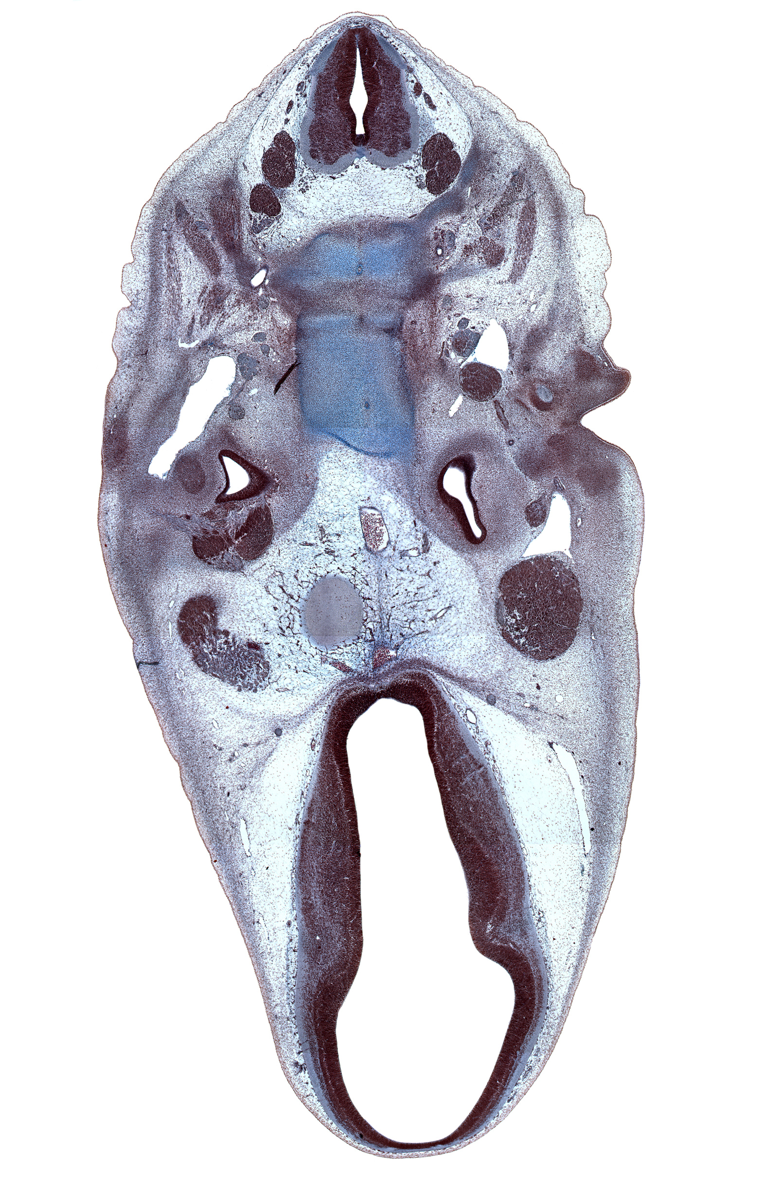 C-1 vertebra (atlas), C-2 / C-3 intervertebral disc, C-3 spinal ganglion, C-3 ventral primary ramus, abducens nerve (CN VI), atlanto-axial joint, auricle, basi-occipital (basal plate), basilar artery, central canal, centrum of C-2 vertebra (axis), descending part of facial nerve (CN VII), dural band for tentorium cerebelli, edge of pons region (metencephalon), geniculate ganglion (CN VII), hypothalamus, inferior ganglion of glossopharyngeal nerve (CN IX), marginal ridge, neural arch of C-2 vertebra (axis), notochord, oculomotor nerve (CN III), osteogenic layer, subarachnoid space, trigeminal ganglion (CN V), trochlear nerve (CN IV), ventral thalamus, zona limitans intrathalamica