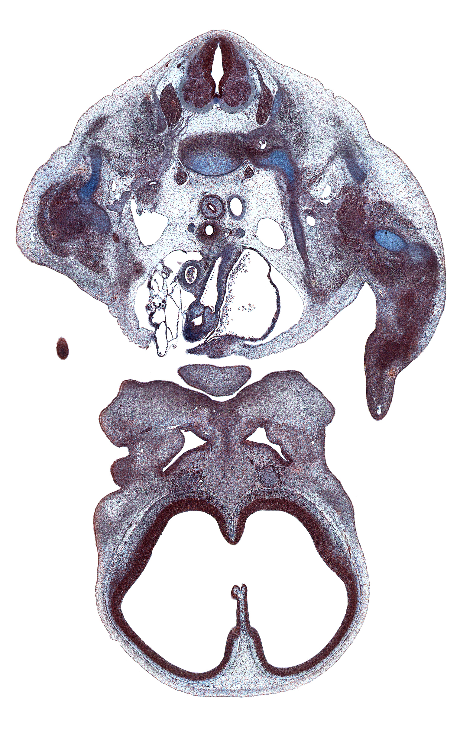 C-7 / T-1 intervertebral disc, T-1 root of brachial plexus, T-1 spinal ganglion, alar plate(s), archipallium, artifact(s), ascending aorta, axillary artery, basal plate, central canal, centrum of C-7 vertebra, cephalic edge of upper limb, chin, descending aorta, falx cerebri region, floor plate, hand plate, head of rib 1, humerus, lateral nasal prominence, lateral ventricle, left vagus nerve (CN X), nasal disc (olfactory placode), neopallium, olfactory bulb, olfactory filia (CN I), paleopallium, precardinal vein, precardinal vein (internal jugular vein), pulmonary semilunar valve, pulmonary trunk, roof plate, sulcus limitans, sympathetic trunk, telencephalon medium