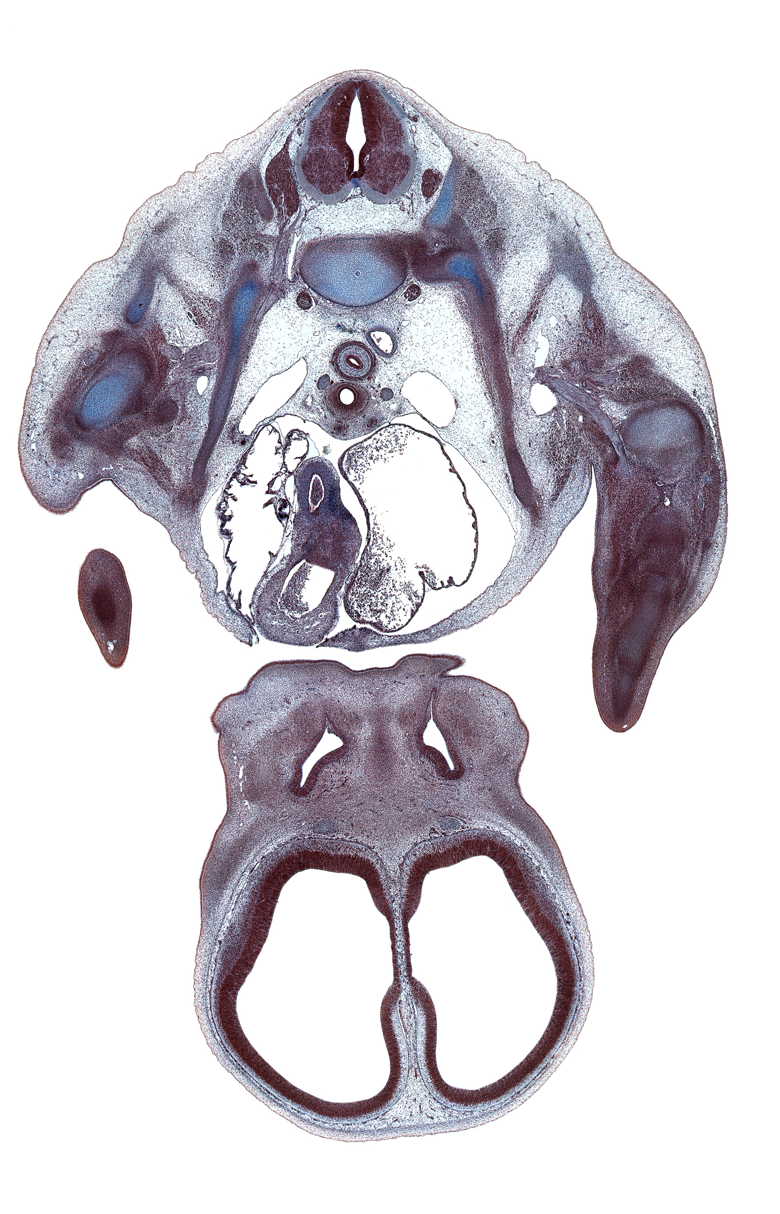 T-1 / T-2 intervertebral disc, T-2 spinal ganglion, aorta, artifact(s), ascending aorta, centrum of T-1 vertebra, cerebral vesicle (telencephalon), esophagus, falx cerebri region, head of rib 2, infundibulum of right ventricle, lateral ventricle, left atrium, maxillary prominence of pharyngeal arch 1, medial nasal prominence(s), nasal fin, nasal septal cartilage condensation, olfactory bulb, phrenic nerve, precardinal vein, right atrium, right lobe of thymus gland, scapula, serratus anterior muscle, shaft of rib 2, subarachnoid space, subclavian vein, superior vena cava, sympathetic trunk, trachea, vagus nerve (CN X)