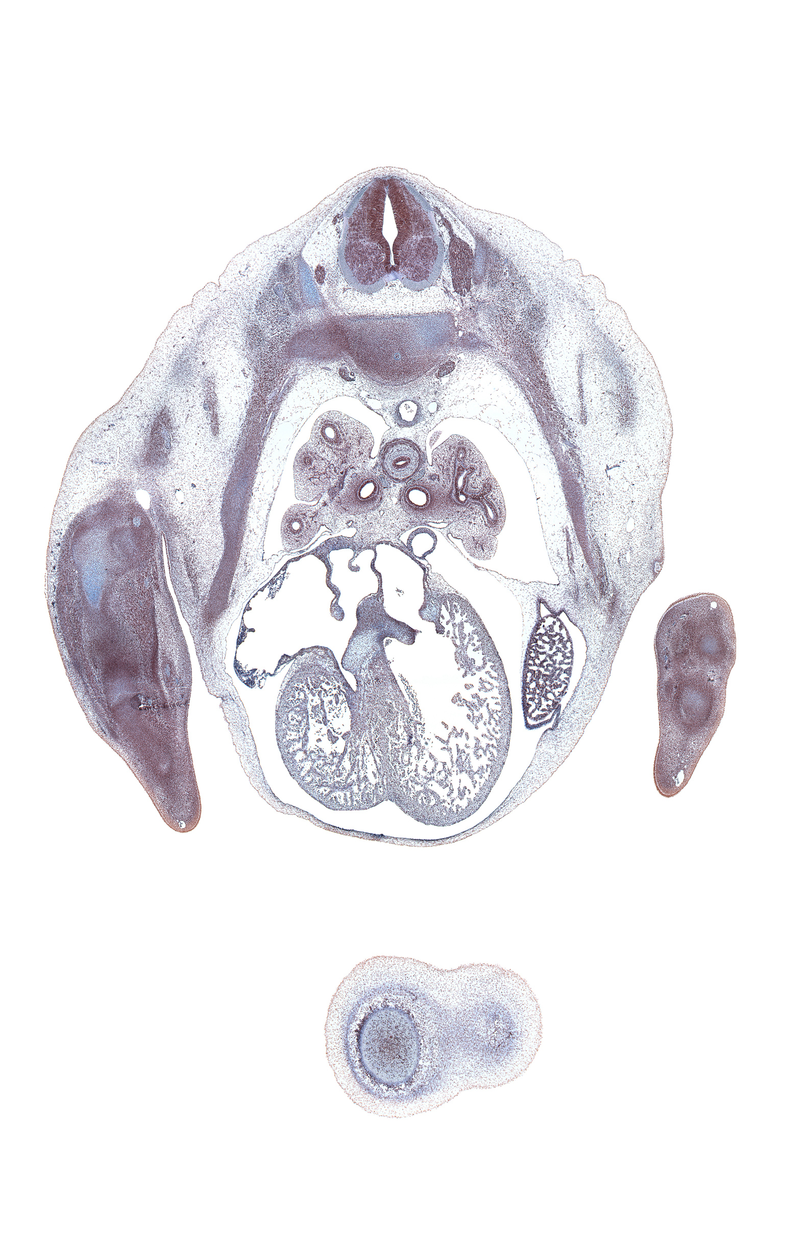 T-4 spinal ganglion, anterior tertiary bronchus, apical posterior tertiary bronchus, cephalic edge of lower lobe of left lung, cephalic edge of mammary gland, extensor compartment of arm, heart prominence, horizontal fissure, iliocostalis muscle, left lobe of liver, longissimus muscle, middle lobe of right lung, neural arch, osteogenic layer, pectoralis major muscle, pericardial cavity, pleural cavity, pleuropericardial membrane, right atrioventricular (tricuspid) valve, right atrium, right primary bronchus, right venous valve, secondary interatrial foramen (foramen secundum), semispinalis muscle, subarachnoid space, superior hemi-azygos vein, upper lobe of left lung, upper lobe of right lung