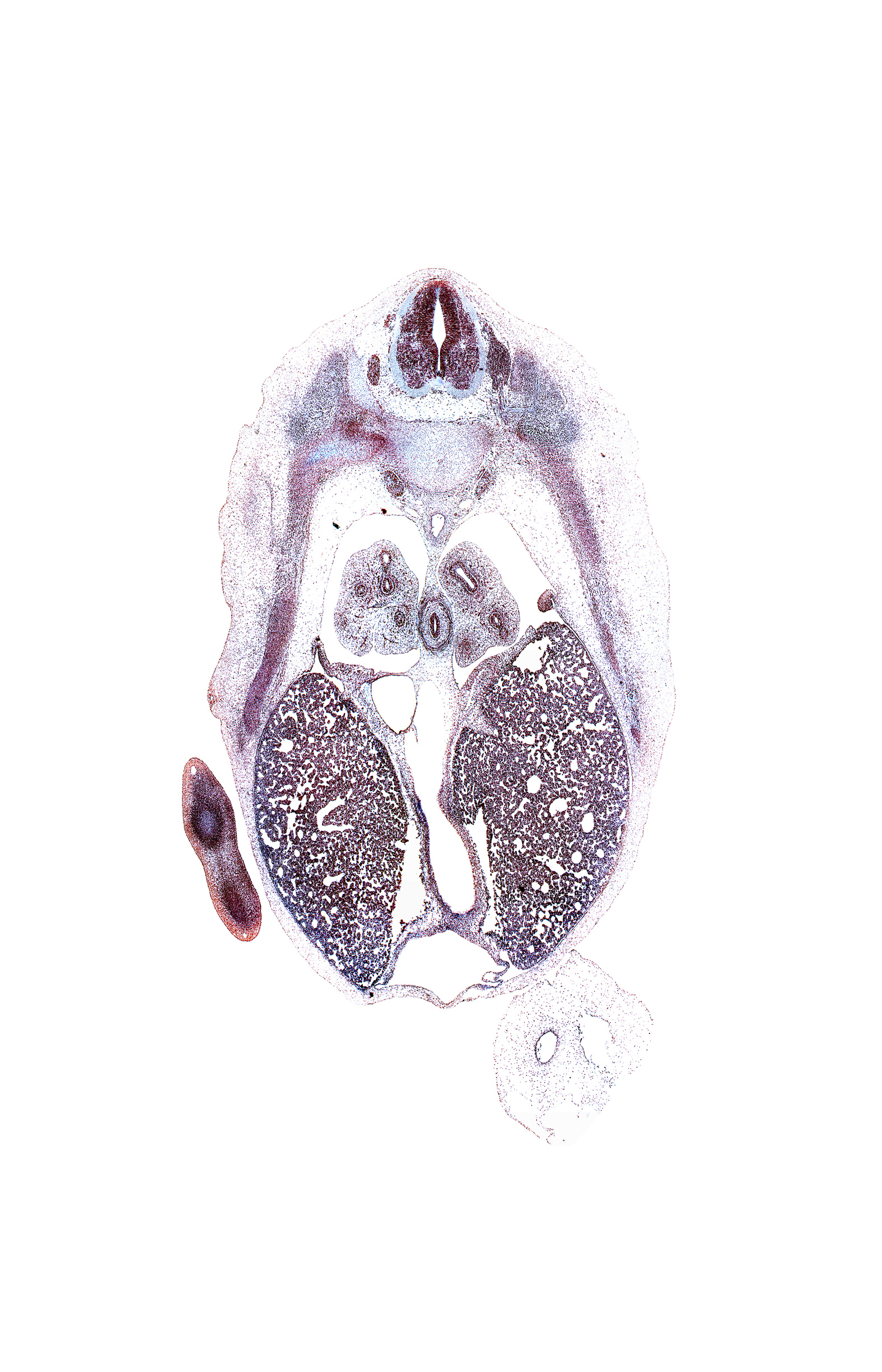 T-6 spinal ganglion, azygos vein, dorsal primary ramus, inferior vena cava, left lobe of liver, lower lobe of left lung, lower lobe of right lung, marginal vein, palmar surface of hand plate, pericardial cavity, pleuropericardial membrane, pleuroperitoneal foramen, pleuroperitoneal membrane, rib 7, right lobe of liver, subarachnoid space, superior hemi-azygos vein, sympathetic trunk, tip of rib 8
