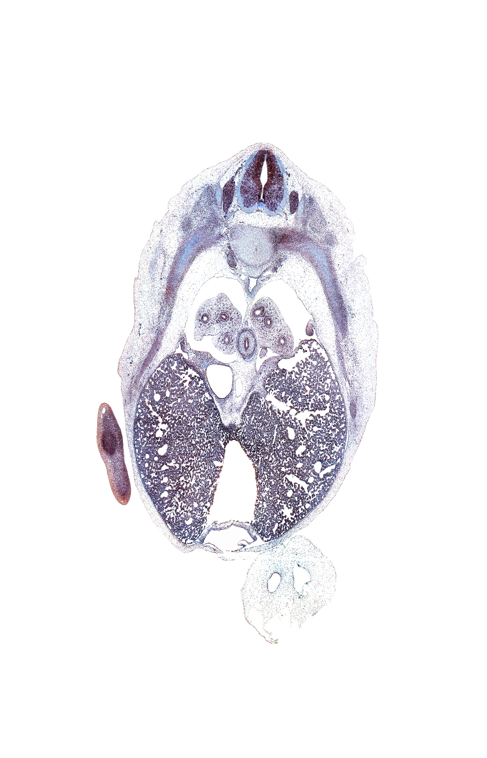 T-6 spinal ganglion, inferior vena cava, pericardial cavity, peritoneal cavity, rib 7, rib 8