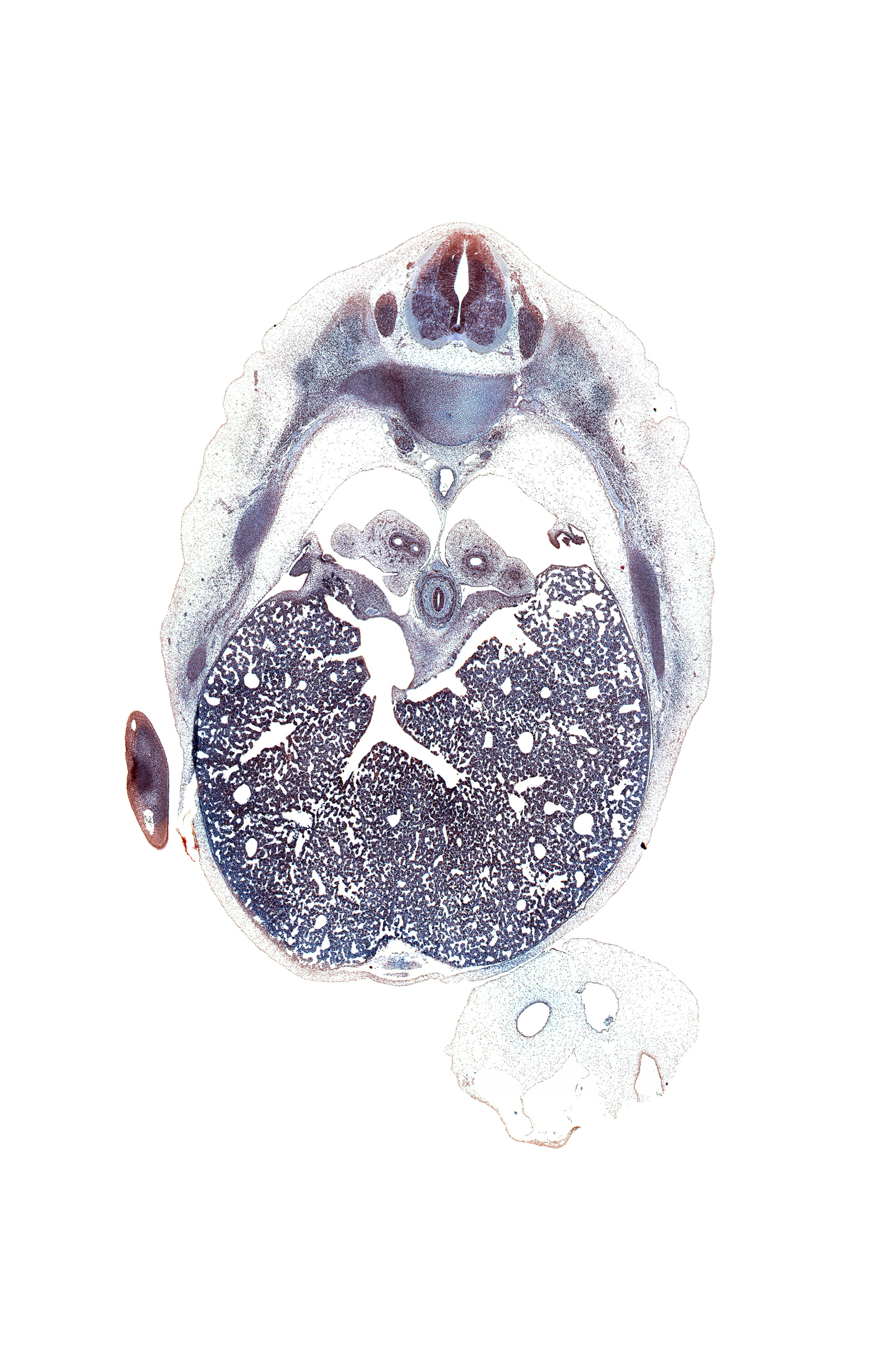 T-6 / T-7 intervertebral disc, T-7 spinal ganglion, aorta, caudal edge of pericardial sac, dorsal meso-esophagus, efferent hepatic veins, inferior vena cava, left lobe of liver, lower lobe of left lung, lower lobe of right lung, peritoneal cavity, pleural cavity, pleuroperitoneal foramen, pulmonary ligament, rib 8, right lobe of liver