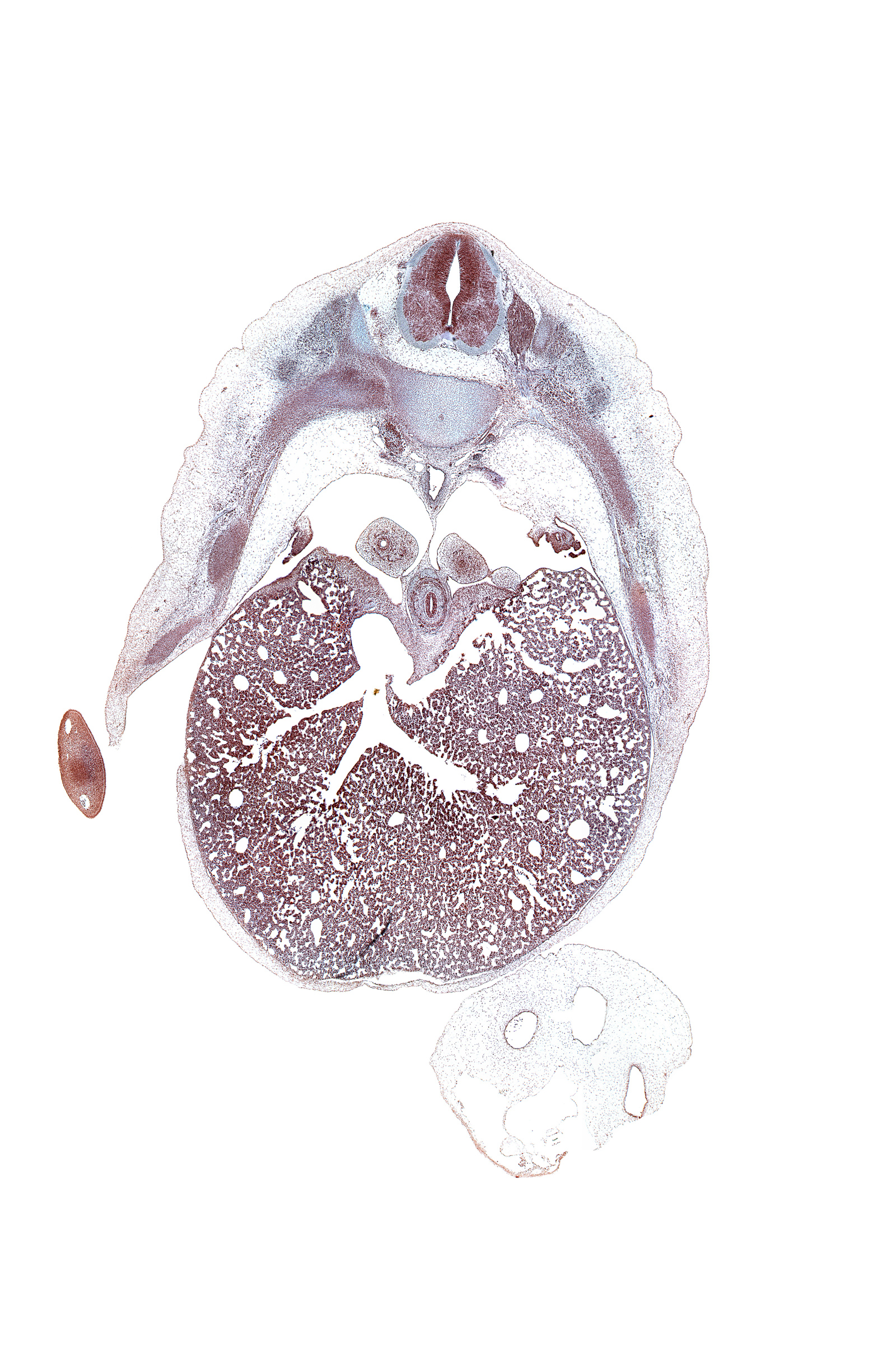 T-7 spinal ganglion, aorta, artifact(s), dorsal meso-esophagus, efferent hepatic veins, inferior vena cava, left lobe of liver, lower lobe of right lung, pleuroperitoneal foramen, pulmonary ligament, rib 8, sympathetic trunk