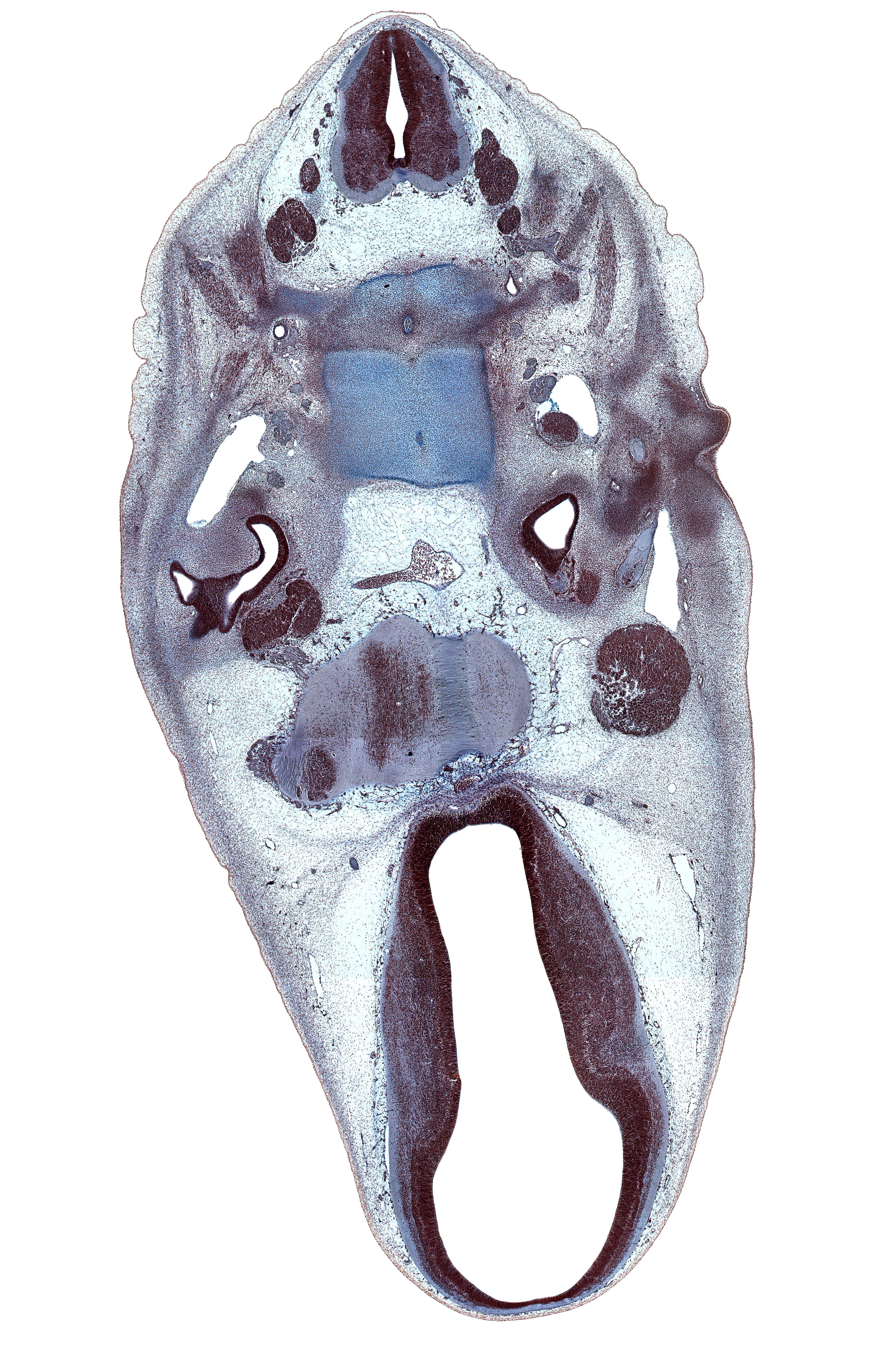 C-1 spinal nerve, C-1 vertebra (atlas), C-2 spinal ganglion, C-2 spinal nerve, C-3 spinal ganglion, atlanto-occipital joint, basi-occipital (basal plate), basilar artery, decussation, dural band for tentorium cerebelli, geniculate ganglion (CN VII), hypoglossal nerve (CN XII), notochord (dens region), osteogenic layer, primary head vein, roof plate of diencephalon, root of abducens nerve (CN VI), saccule(s), subarachnoid space, vagus nerve (CN X), vascular plexus, vertebral artery
