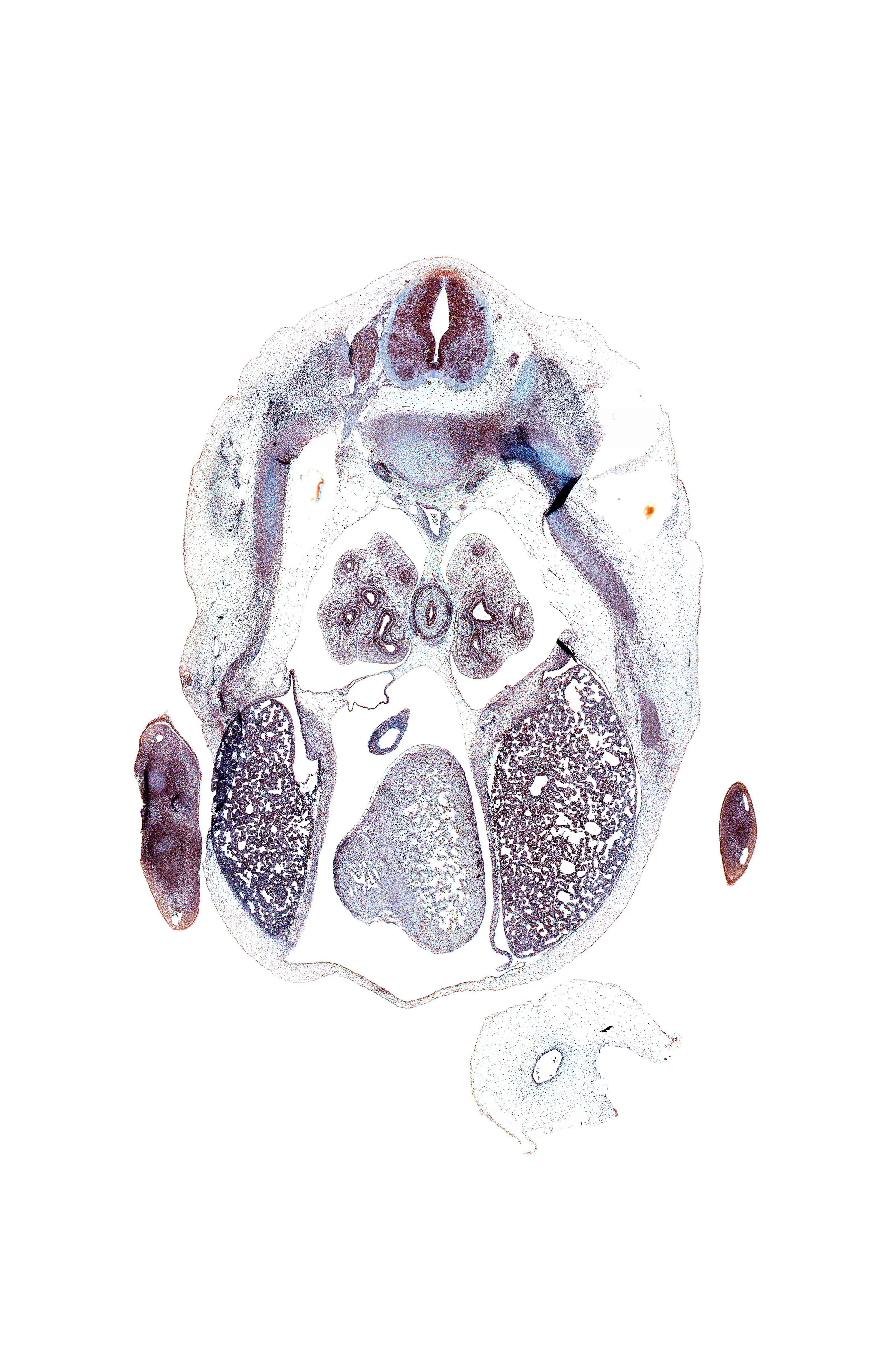 T-6 / T-7 intervertebral disc, T-6 spinal ganglion, aorta, central tendon of diaphragm, coronary sinus, hand plate, heart prominence, inferior vena cava, junction of diaphragm and phrenic nerve, latissimus dorsi muscle, left lobe of liver, loose mesenchyme, mammary gland, metacarpal cartilage, neural arch, notochord, pericardial cavity, peritoneal cavity, pleural cavity, pleuropericardial membrane, rib 6, right lobe of liver, sympathetic trunk