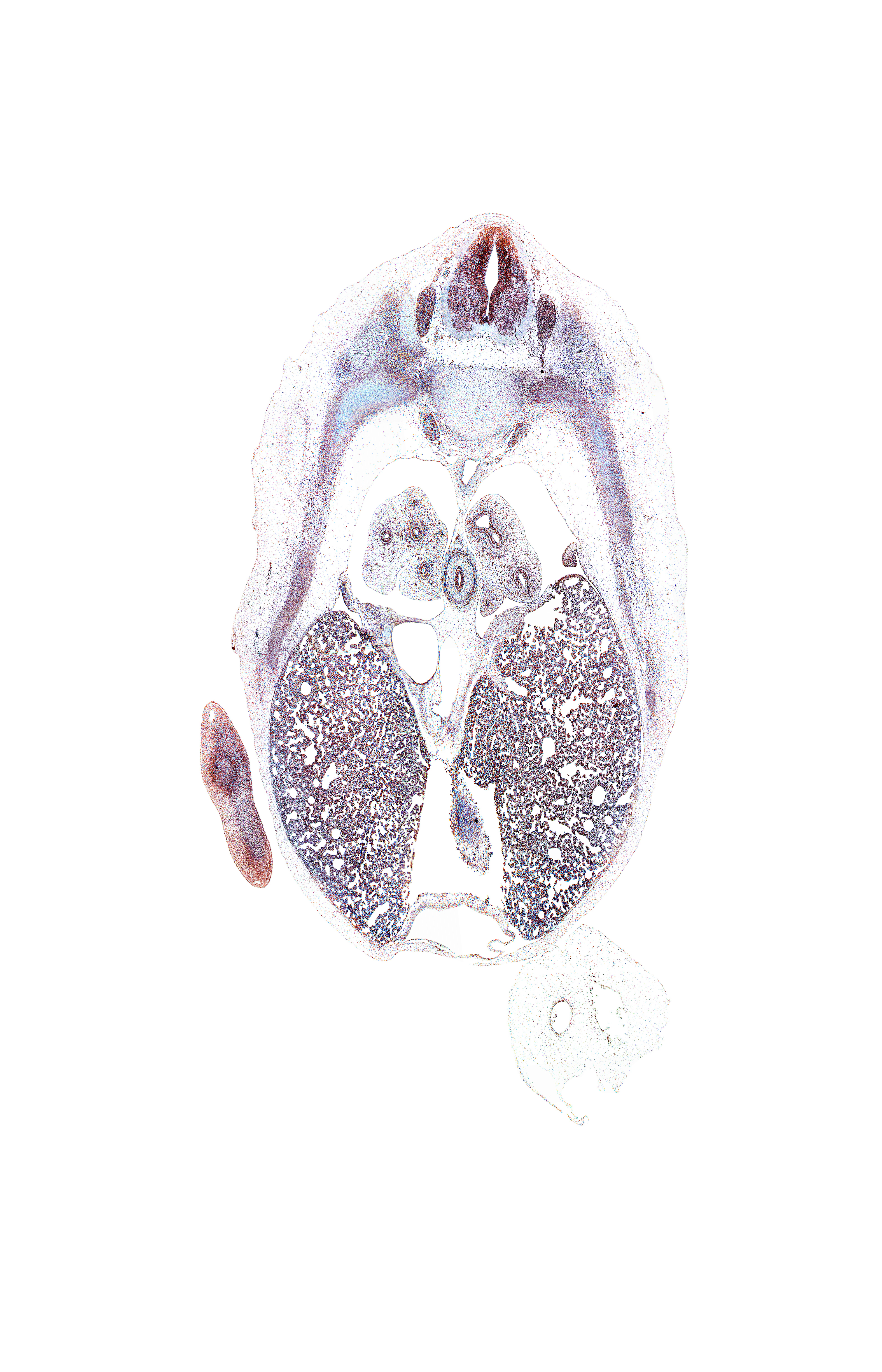 T-6 spinal ganglion, aorta, caudal edge of pericardial cavity, caudal edge of pericardial sac, inferior vena cava, pericardial cavity, pleuroperitoneal foramen, rib 7, rib 8