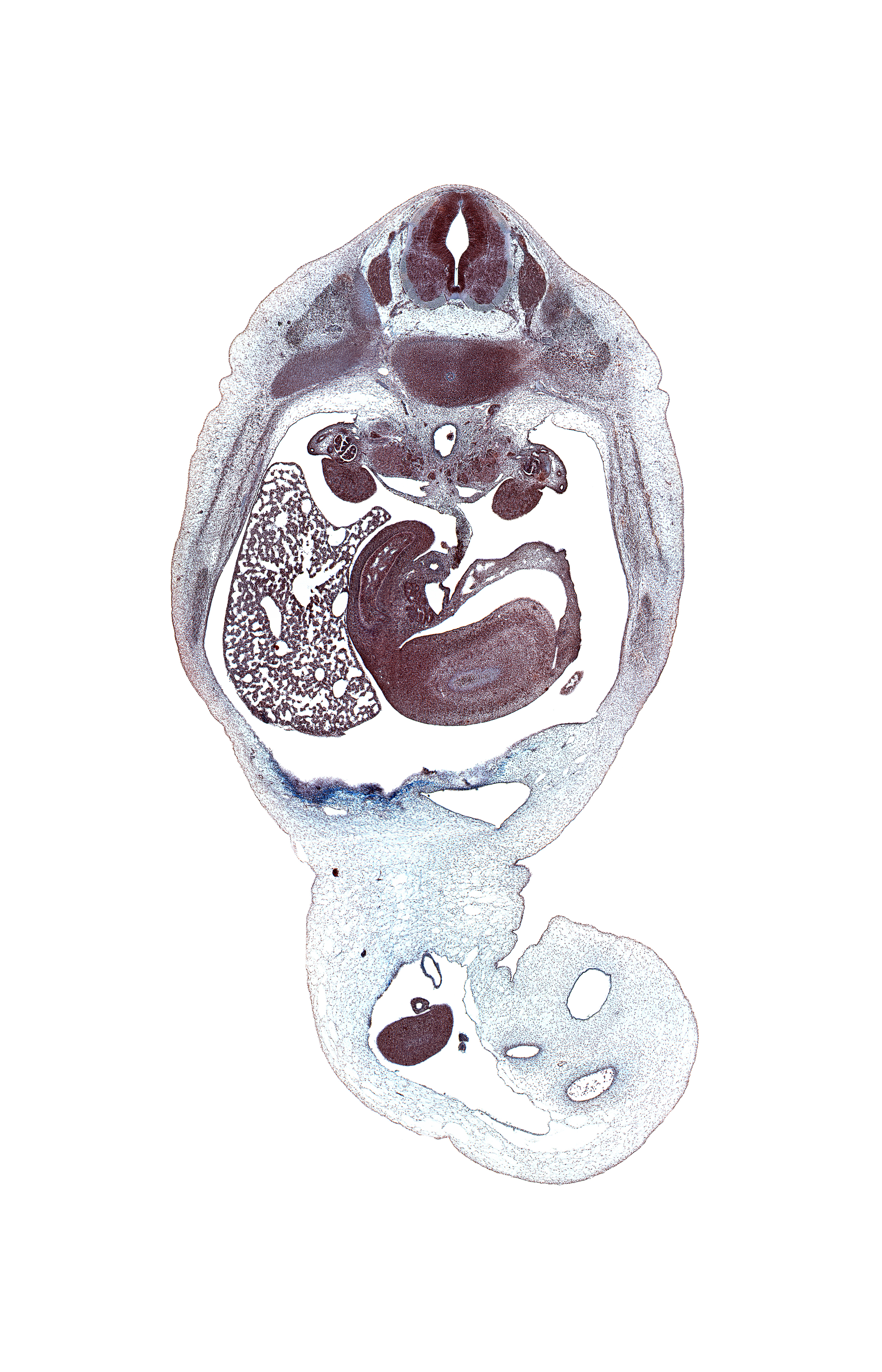 T-11 / T-12 intervertebral disc, T-11 spinal ganglion, allantois, aorta, caudal edge of left lobe of liver, duodenum (second part), gonad, head of pancreas, hepatic portal vein, inferior vena cava, kidney (metanephros), latissimus dorsi muscle, left subcardinal vein, left umbilical artery, lesser sac, mesonephric duct, mesonephros, midpoint of midgut, neural arch, omphalomesenteric vessels, right lobe of liver, right umbilical artery, splenic vein, subarachnoid space, superior mesenteric artery, umbilical coelom, umbilical vein, wall of stomach