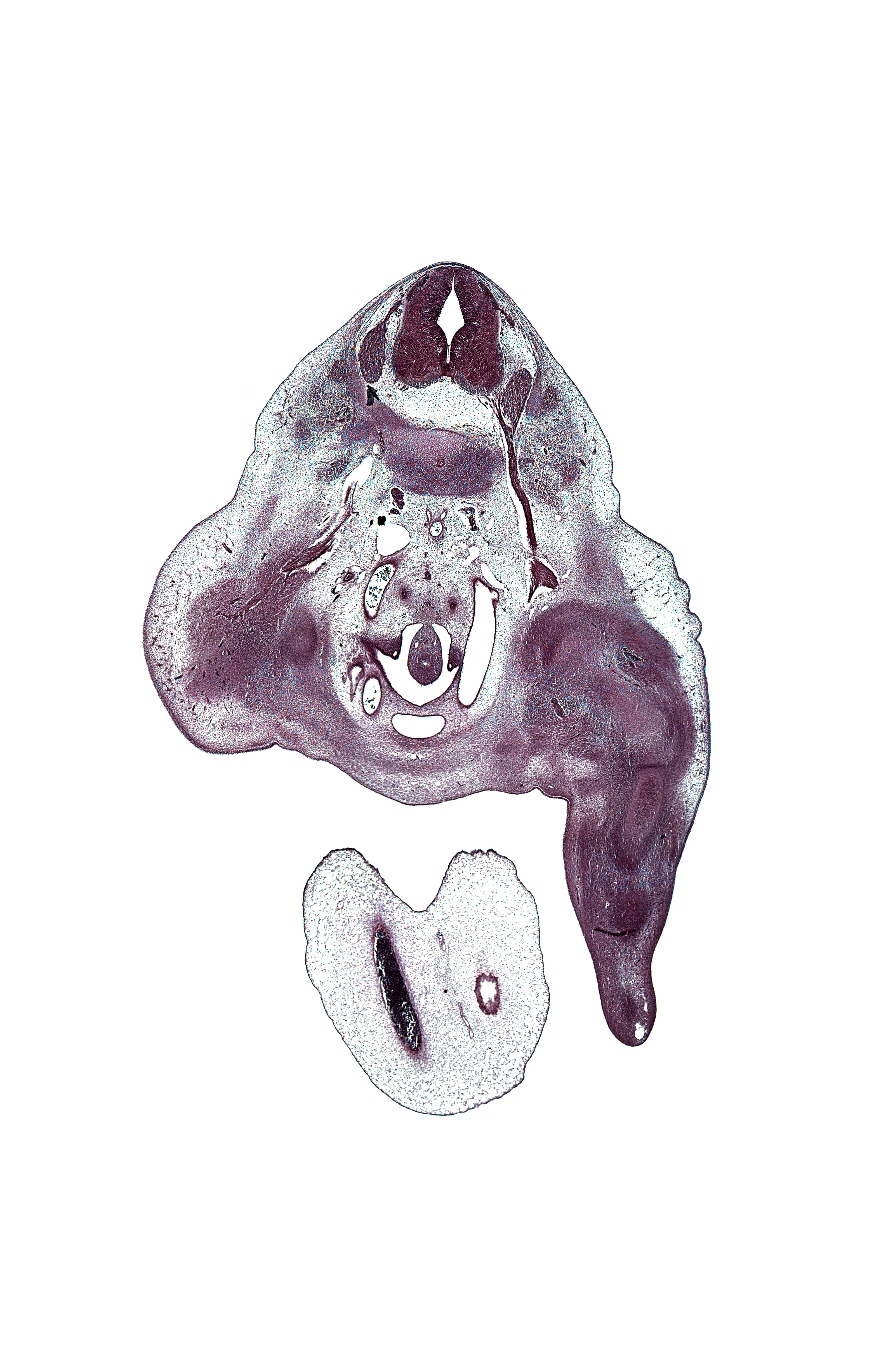 L-3 / L-4 intervertebral disc, L-3 spinal ganglion, L-3 ventral primary ramus, allantois, ankle region, blastemata of extensor muscles in leg, blastemata of flexor muscles in leg, dorsal root(s), edge of right umbilical artery, edge of umbilical vein, femur, hindgut, knee joint, left umbilical artery, lumbar plexus, median sacral artery, mesonephric duct, neural arch, origin of external iliac artery, osteogenic layer, pedicle, peritoneal cavity, plantar surface of foot plate, right common iliac artery, right umbilical artery, tibia, umbilical cord, ureter, urinary bladder, ventral root
