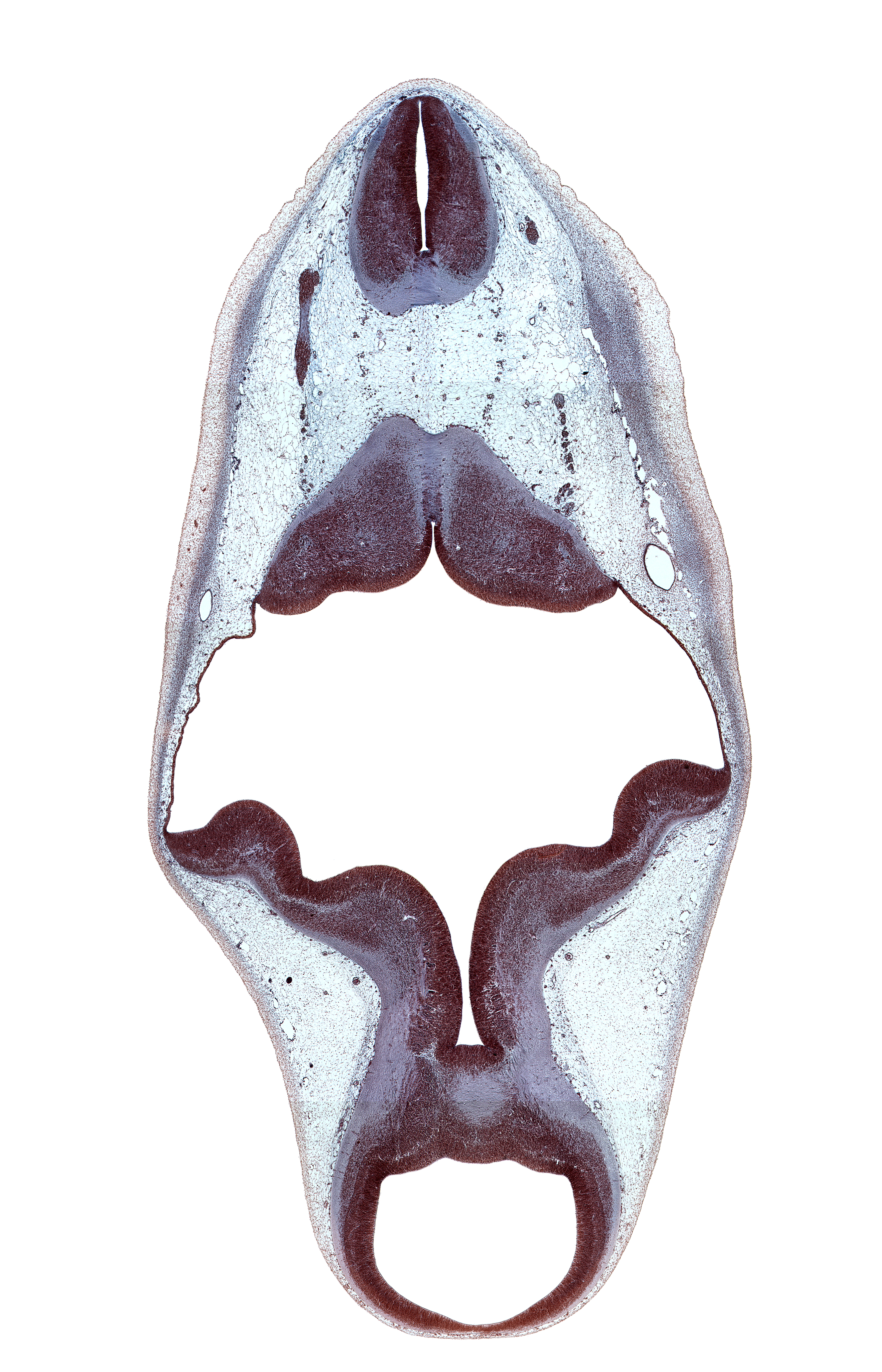 accessory nerve (CN XI), alar plate of metencephalon (cerebellum), alar plate(s), basal plate, cerebral aqueduct (mesocoele), cerebral peduncle, head mesenchyme, myelencephalon, osteogenic layer, posterior dural venous plexus, region of cervical flexure, rhombencoel (fourth ventricle), roof of rhombencoel (fourth ventricle), root of hypoglossal nerve (CN XII), sulcus limitans, tectum, tegmentum, trochlear nerve (CN IV)
