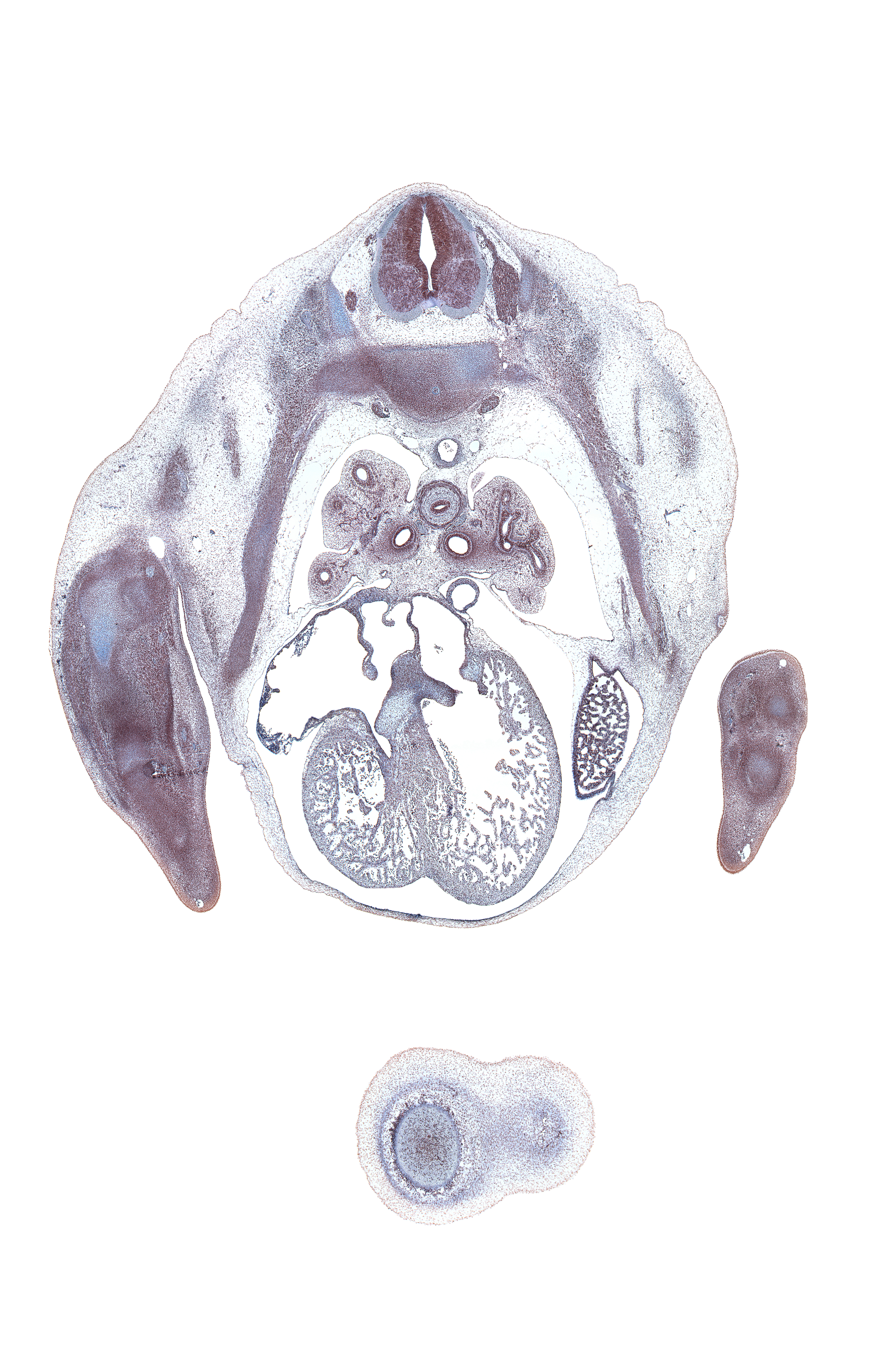 T-4 spinal ganglion, anterior tertiary bronchus, apical posterior tertiary bronchus, cephalic edge of lower lobe of left lung, cephalic edge of mammary gland, extensor compartment of arm, heart prominence, horizontal fissure, iliocostalis muscle, left lobe of liver, longissimus muscle, middle lobe of right lung, neural arch, osteogenic layer, pectoralis major muscle, pericardial cavity, pleural cavity, pleuropericardial membrane, right atrioventricular (tricuspid) valve, right atrium, right primary bronchus, right venous valve, secondary interatrial foramen (foramen secundum), semispinalis muscle, subarachnoid space, superior hemi-azygos vein, upper lobe of left lung, upper lobe of right lung