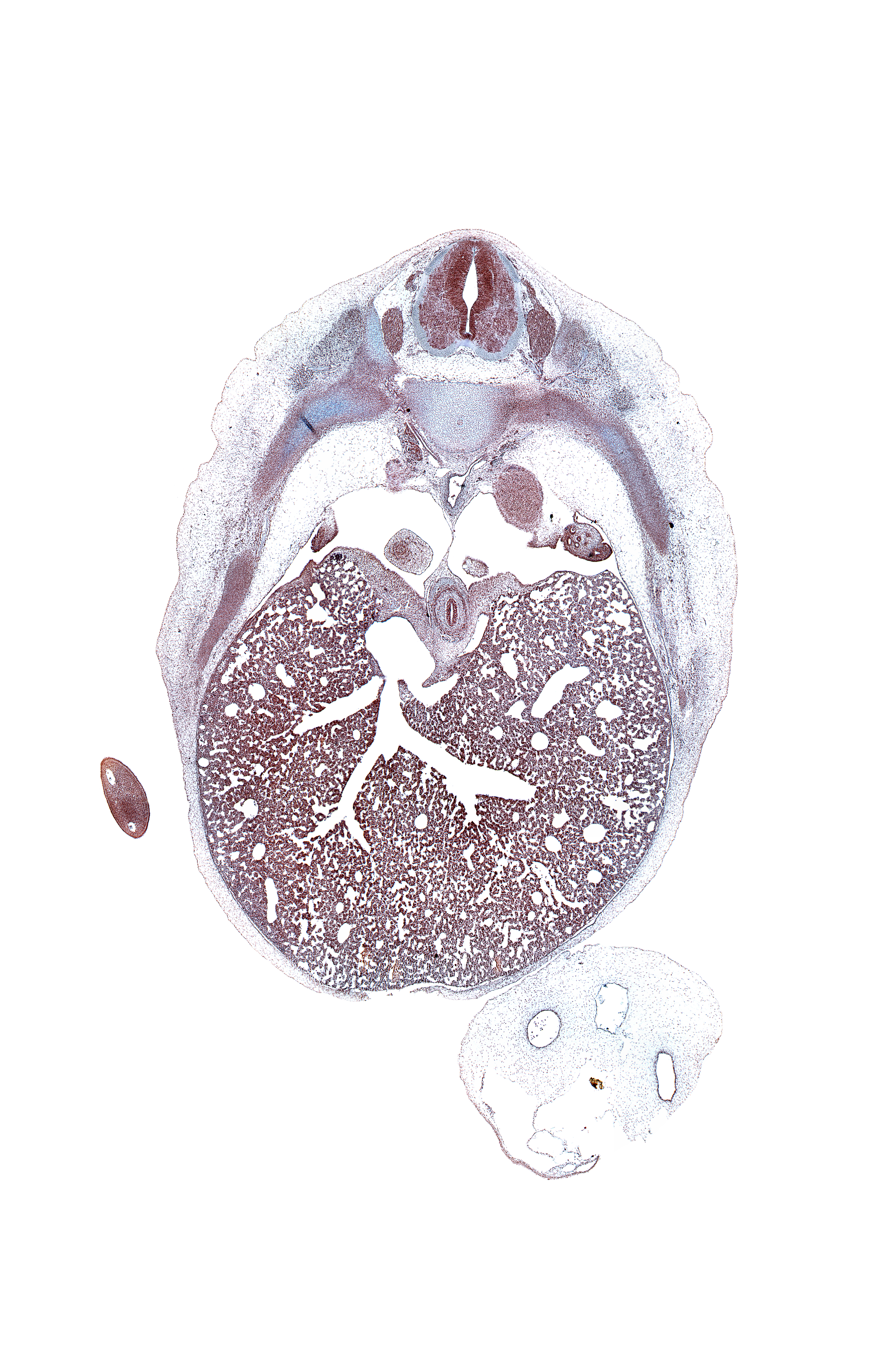 T-7 dorsal root, T-7 spinal ganglion, anterior gastric nerve (CN X), artifact(s), caudal edge of lower lobe of left lung, cephalic edge of suprarenal gland cortex, efferent hepatic vein, esophagus muscularis, greater splanchnic nerve, hand plate, inferior vena cava, left lobe of liver, liver prominence, lower lobe of right lung, marginal vein, osteogenic layer, pleural cavity, pleuroperitoneal foramen, posterior gastric nerve (CN X), posterior intercostal artery, rib 8, right lobe of liver, sympathetic trunk