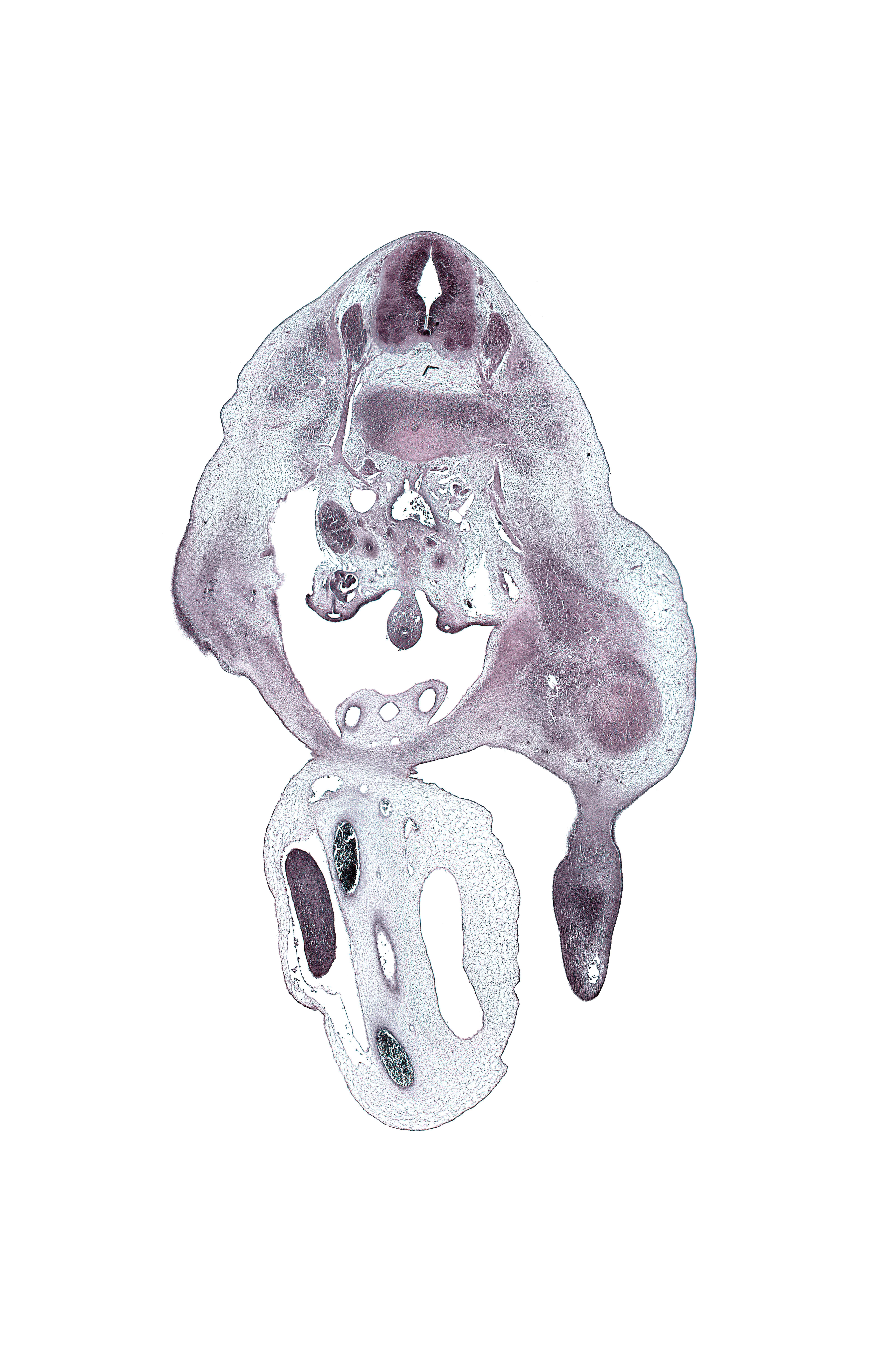 L-2 spinal ganglion, L-2 spinal nerve, allantois, aortic bifurcation, blastemata of anterior thigh muscles, dorsal root(s), dorsum of foot plate, edge of left umbilical artery, edge of proximal limb of herniated midgut, external iliac vessels, head of femur, hindgut, inferior pole of right kidney (metanephros), inferior vena cava, left umbilical artery, lumbar plexus, marginal vein, mesonephric duct, right umbilical artery, sympathetic trunk, umbilical coelom, umbilical vein, ureter, urinary bladder, ventral root