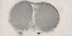 Serial section showing both polar bodies