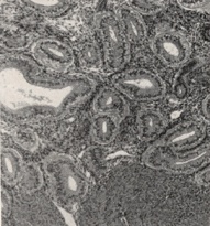 The basal portion of the mucosa