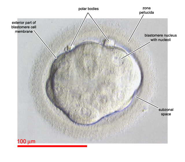 Final phase of compaction in an embryo