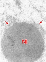 Nucleolus of a blastomere of a 4-cell embryo