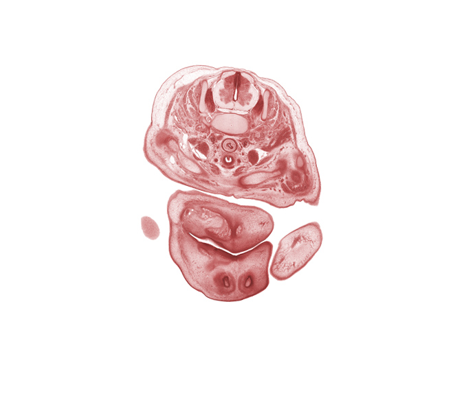 C-6 spinal ganglion, C-6 spinal nerve, blastema of facial muscle, clavicle, edge of upper limb, inferior parathyroid gland, internal carotid artery, internal jugular vein, isthmus of thyroid gland, middle scalene muscle, neural arch, nose, notochord, osteogenic layer, primary palate, suprasternal region, surface ectoderm of upper limb, trapezius muscle