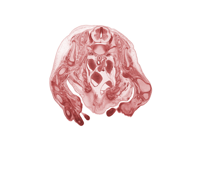 C-8 / T-1 intervertebral disc, C-8 spinal ganglion, central canal, cephalic edge of left atrium, dorsal funiculus, edge of left lobe of thymus gland, edge of mammary gland, head of rib 1, inferior cervical sympathetic ganglion, lateral funiculus, left subclavian artery, left vagus nerve (CN X), radius, rib 4, right atrium, right vagus nerve (CN X), scapula, shaft of humerus, shaft of rib 1, superior vena cava, trapezius muscle, ulna, ulnar nerve, ventral funiculus