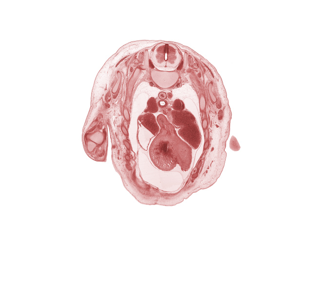 T-2 spinal ganglion, T-2 spinal nerve, anterior interventricular sulcus, aorta, aortic semilunar valve, ascending aorta, caudal end of upper limb, esophagus, heart prominence, left pulmonary artery, left vagus nerve (CN X), left ventricle, pericardial cavity, rib 3, rib 4, right atrium, right pulmonary artery, right vagus nerve (CN X), right ventricle, serratus anterior muscle, sympathetic trunk, trachea