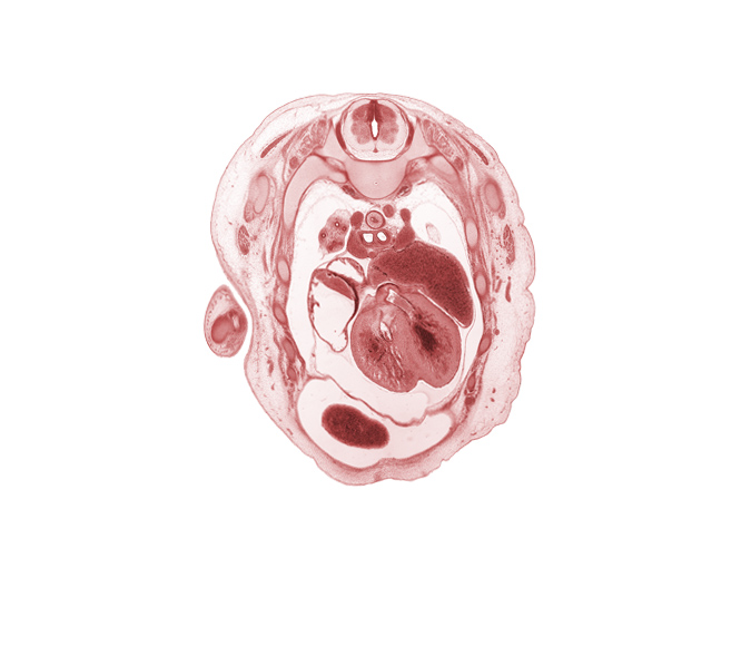 T-3 spinal ganglion, aorta, aortic vestibule, atrioventricular sulcus, auricle of left atrium, azygos vein, left horn of sinus venosus, membranous part of interventricular septum, muscular part of interventricular septum, primary bronchus, rib 3, rib 4, rib 6, right atrium, right lobe of liver, scapula, superior vena cava, sympathetic trunk, trabecular part of right ventricle