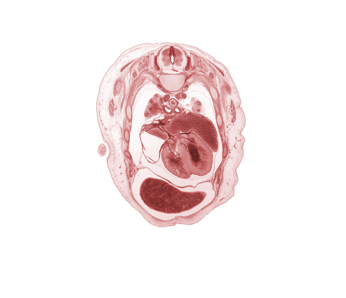 T-3 spinal ganglion, apical segmental bronchus, azygos vein, caudal end of upper limb, central tendon of diaphragm, head of rib 4, iliocostalis muscle, junction of sinus venosus and superior vena cava, left atrium, left horn of sinus venosus, longissimus muscle, muscular part of interventricular septum, pericardial cavity, phrenic nerve, primary bronchus, rhomboid major muscle, rib 5, right atrium, scapula, septum spurium, spinalis muscle, upper lobe of left lung, upper lobe of right lung, upper secondary bronchus