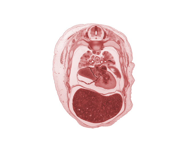 T-4 spinal ganglion, atrioventricular sulcus, azygos vein, central canal, central tendon of diaphragm, common pulmonary vein, esophageal nerve plexus, iliocostalis muscle, left atrioventricular canal, left atrium, left lobe of liver, left ventricle, longissimus muscle, lower secondary bronchus, middle secondary bronchus, neural arch, oblique fissure, papillary muscle, pericardial cavity, pericardial sac, primary interatrial septum (septum primum), rib 5, rib 6, secondary interatrial septum (septum secundum), spinalis muscle, sympathetic trunk, upper lobe of left lung