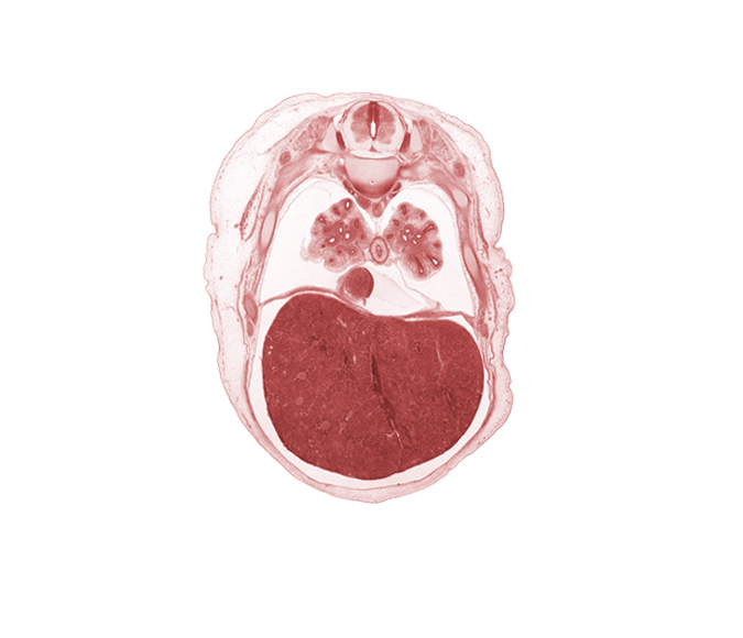 T-6 spinal ganglion, T-6 spinal nerve, dorsal horn of grey matter, intercostal muscle(s), lateral horn of grey matter, left lobe of liver, liver prominence, lower lobe of right lung, muscular part of diaphragm, pericardial cavity, peritoneal cavity, pleural cavity, rib 7, rib 8, right lobe of liver, sympathetic trunk, ventral horn of grey matter