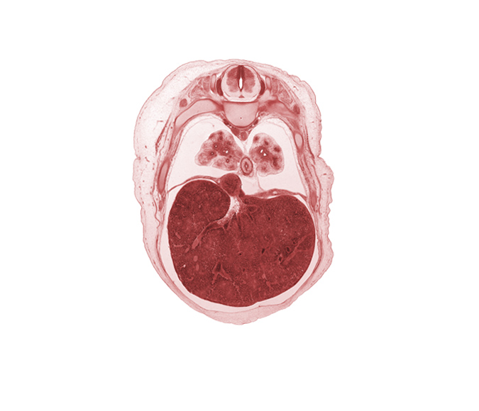 T-6 spinal ganglion, T-7 spinal nerve, aorta, azygos vein, efferent hepatic vein, esophagus, inferior vena cava, latissimus dorsi muscle, left lobe of liver, liver prominence, lower lobe of left lung, lower lobe of right lung, peritoneal cavity, pleural cavity, pulmogenic coat, rectus abdominis muscle, rib 8, right lobe of liver