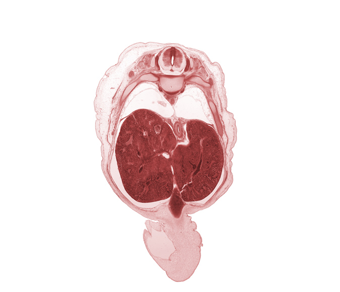 T-9 spinal ganglion, T-9 spinal nerve, amnion on surface of umbilical cord, aorta, azygos vein, dorsal meso-esophagus, esophagus, hepatic portal vein, iliocostalis muscle, inferior vena cava (hepatic part), left lobe of liver, longissimus muscle, lung, right, rib 10, rib 9, right lobe of liver, spinalis muscle, sympathetic trunk, umbilical coelom, umbilical vein