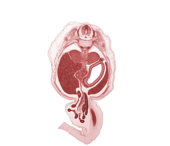 T-11 / T-12 intervertebral disc, T-11 rib head, T-11 spinal ganglion, aorta, bile duct, body of stomach, descending part of duodenum (second part), distal limb of herniated midgut, jejunum, junction of omphaloenteric and superior mesenteric arteries, latissimus dorsi muscle, left lobe of liver, proximal limb of herniated midgut, superior mesenteric artery, suprarenal gland cortex, suprarenal gland medulla, testis, umbilical vein