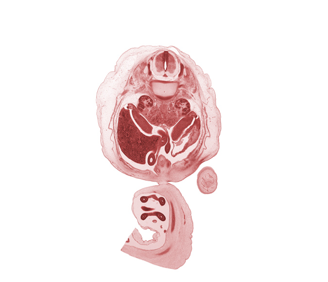 L-1 spinal ganglion, T-12 spinal ganglion, aorta, apex of urinary bladder, centrum of L-1 vertebra, duodenum, hindgut (colon), jejunum, kidney (metanephros), left umbilical artery, lesser sac (omental bursa), mesocolon, omphalomesenteric artery, proximal limb of herniated midgut, right lobe of liver, right umbilical artery, spleen, tail of dorsal pancreas, testis, vas deferens (mesonephric duct)