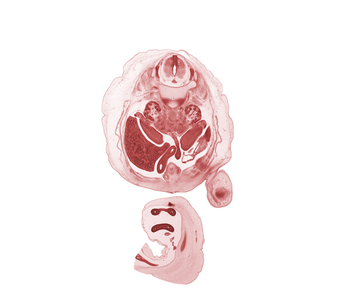 L-1 / L-2 intervertebral disc, L-1 spinal ganglion, aorta, apex of urinary bladder, central canal, duodenum, edge of femur, hilum of kidney (metanephros), hindgut (colon), inferior mesenteric artery, inferior mesenteric ganglion, jejunum, left umbilical artery, omphalomesenteric artery, proximal limb of herniated midgut, right lobe of liver, right umbilical artery, sartorius muscle, spleen, testis