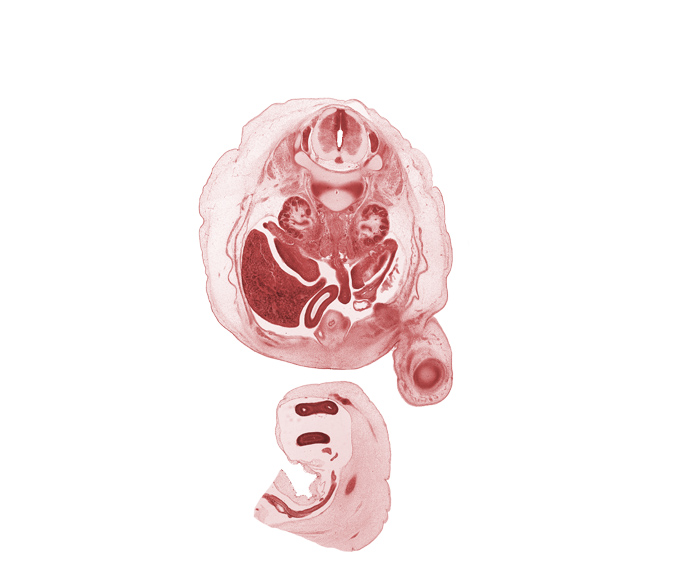 L-1 / L-2 intervertebral disc, L-1 spinal ganglion, L-1 spinal nerve, aorta, caudal edge of lesser sac (omental bursa), central canal, centrum of L-2 vertebra, femur, hindgut (colon), inferior vena cava (subcardinal vein), junction of duodenum and jejunum, notochord, omphalomesenteric artery, proximal limb of herniated midgut, right lobe of liver, right umbilical artery, testis, urinary bladder