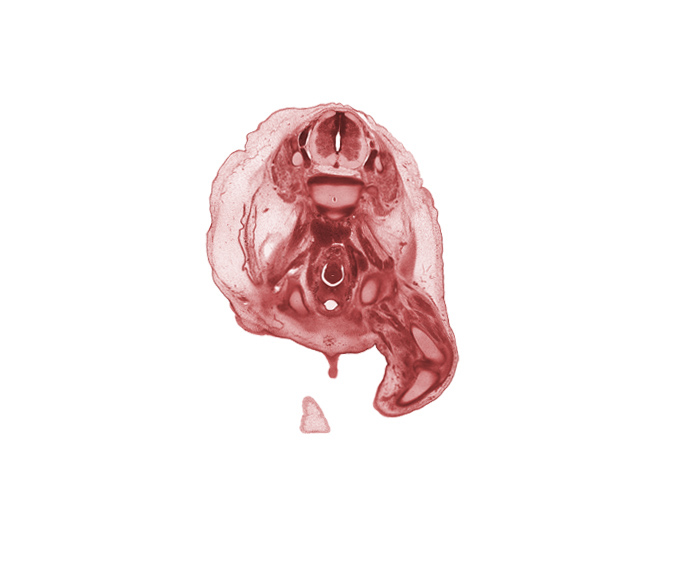 L-2 spinal ganglion, L-3 / L-4 intervertebral disc, L-3 spinal ganglion, L-3 spinal nerve, aorta, caudal edge of umbilical coelom, caudal edge of umbilical cord, cephalic edge of penis, femoral artery, femoral nerve, femur, gubernaculum of testis, inferior vena cava (sacrocardinal vein), intermediate zone, knee joint, marginal zone, mesosigmoid, notochord, psoas major muscle, sigmoid colon, tibia, ureter, urinary bladder, vas deferens (mesonephric duct), ventricular zone