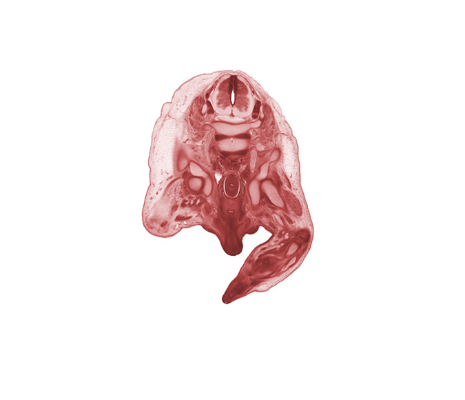 L-4 / L-5 intervertebral disc, L-4 spinal ganglion, L-4 spinal nerve, centrum of L-5 vertebra, femur, fibula, hip joint, ilium, internal iliac vein, ischium, lumbosacral trunk, neural arch, notochord, osteogenic layer, popliteal artery, rectum, scrotal swelling, shaft of penis, urethra