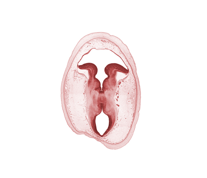 artifact separation(s), cerebral aqueduct (mesocoele), cerebral peduncle, intermediate zone, loose connective tissue, marginal zone, osteogenic layer, rhombencoel (fourth ventricle), sulcus limitans, surface ectoderm, trochlear nerve (CN IV), ventricular zone