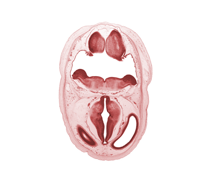 artifact separation(s), basilar artery, choroid fissure, dorsal thalamus, dural band for tentorium cerebelli, edge of lateral ventricle, hypothalamic sulcus, lateral ventricle, metencephalon, myelencephalon (medulla oblongata), osteogenic layer, posterior communicating artery, rhombencoel (fourth ventricle), subarachnoid space, zona limitans intrathalamica