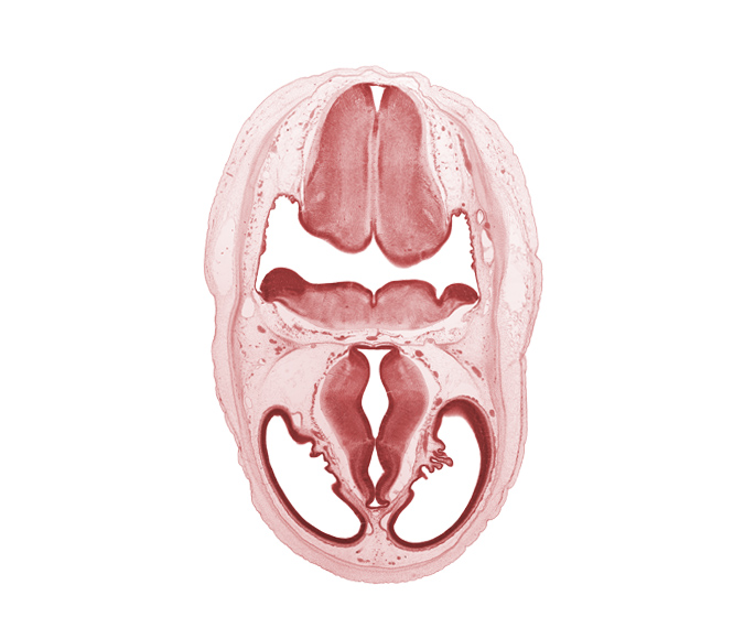 artifact separation(s), basilar artery, choroid plexus, endolymphatic sac, lateral ventricle, myelencephalon (medulla oblongata), obex, oculomotor nerve (CN III), pons region (metencephalon), rhombencoel (fourth ventricle), roof of rhombencoel (fourth ventricle), sensory decussation, trochlear nerve (CN IV), zona limitans intrathalamica