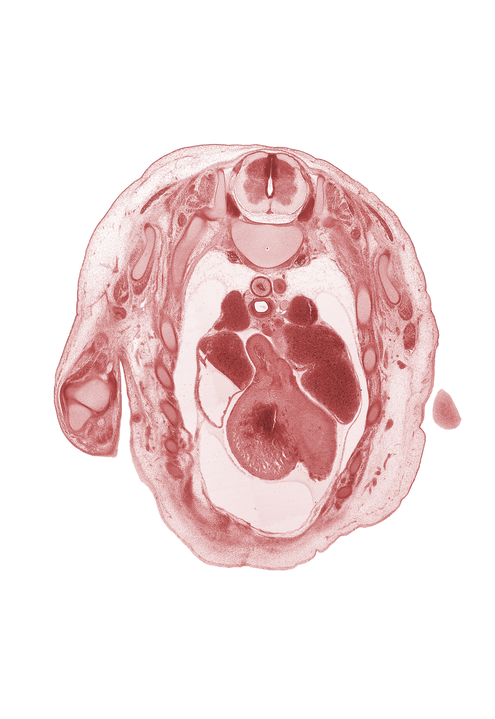 T-2 spinal ganglion, T-2 spinal nerve, anterior interventricular sulcus, aorta, aortic semilunar valve, ascending aorta, caudal end of upper limb, esophagus, heart prominence, left pulmonary artery, left vagus nerve (CN X), left ventricle, pericardial cavity, rib 3, rib 4, right atrium, right pulmonary artery, right vagus nerve (CN X), right ventricle, serratus anterior muscle, sympathetic trunk, trachea
