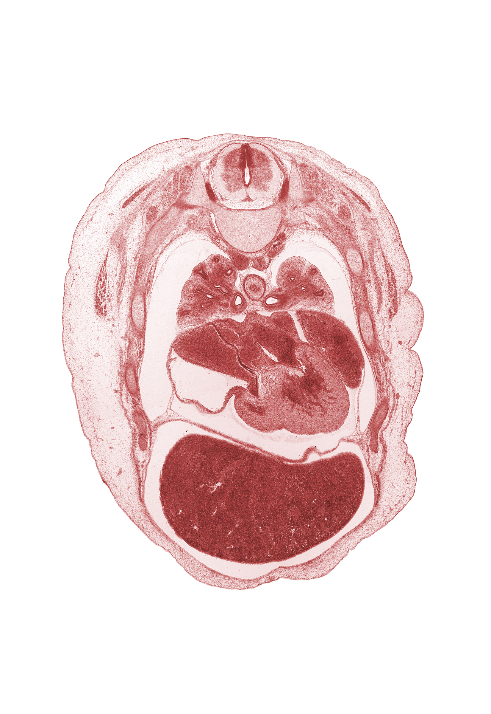 T-4 spinal ganglion, T-4 spinal nerve, aorta, dorsal horn of grey matter, esophagus, lateral horn of grey matter, left atrium, left lobe of liver, left posterior intercostal artery, left ventricle, pericardial cavity, pericardial sac, peritoneal cavity, pleural cavity, primary bronchus, pulmogenic coat, rib 5, rib 6, rib 7, right atrium, right lobe of liver, upper lobe of left lung, upper lobe of right lung, ventral horn of grey matter