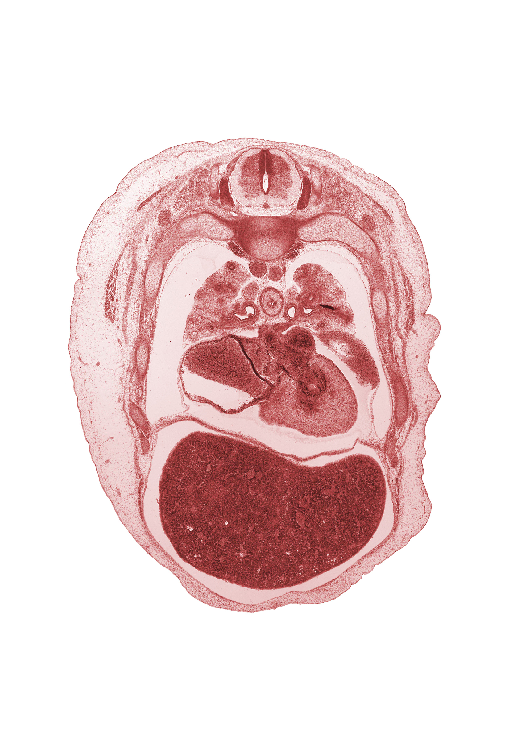 T-4 spinal ganglion, atrioventricular sulcus, azygos vein, central canal, central tendon of diaphragm, common pulmonary vein, esophageal nerve plexus, iliocostalis muscle, left atrioventricular canal, left atrium, left lobe of liver, left ventricle, longissimus muscle, lower secondary bronchus, middle secondary bronchus, neural arch, oblique fissure, papillary muscle, pericardial cavity, pericardial sac, primary interatrial septum (septum primum), rib 5, rib 6, secondary interatrial septum (septum secundum), spinalis muscle, sympathetic trunk, upper lobe of left lung