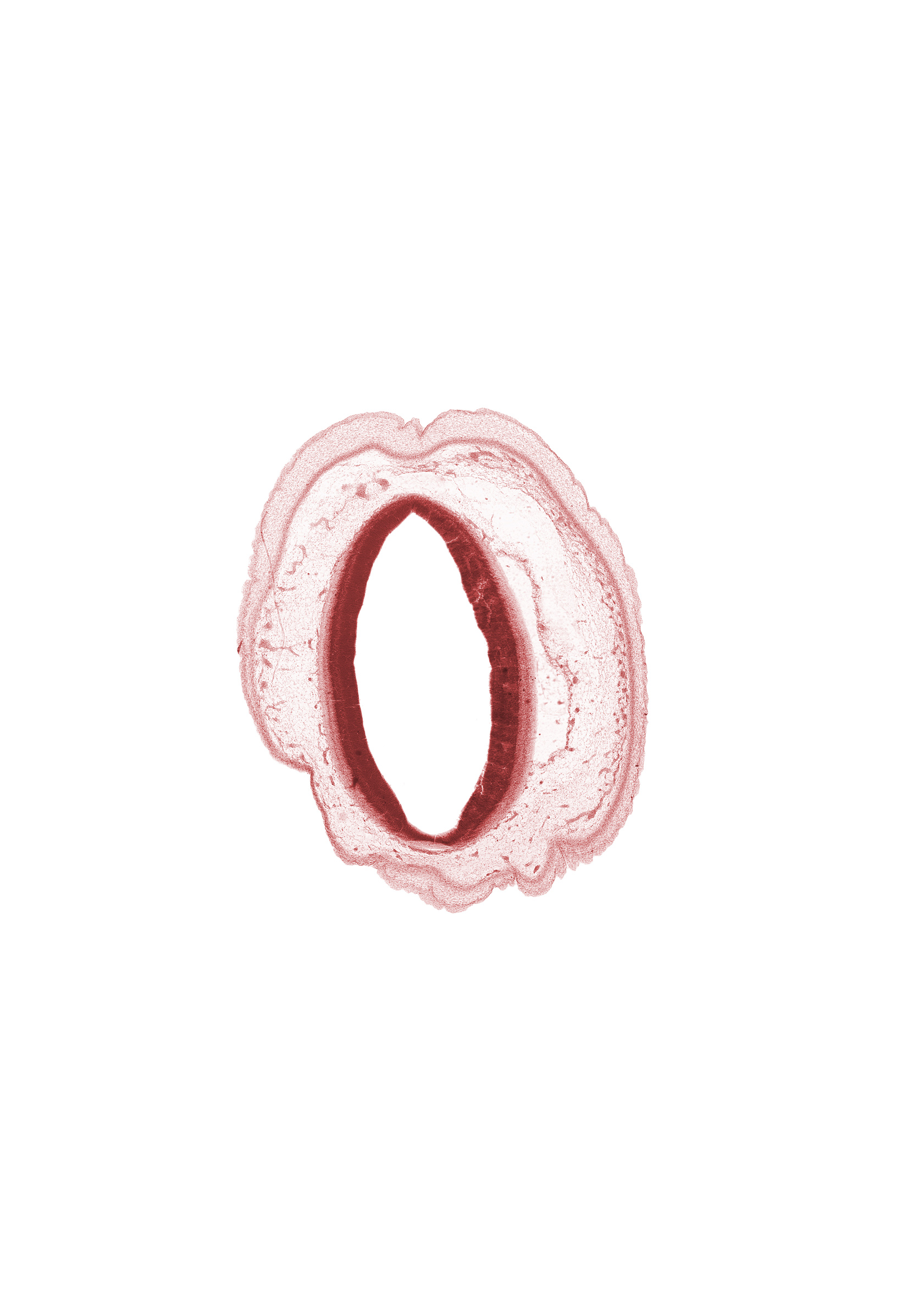 artifact separation(s), cerebral aqueduct (mesencoel), intermediate zone, marginal zone, osteogenic layer, roof plate of mesencephalon, tectum of mesencephalon, ventricular zone
