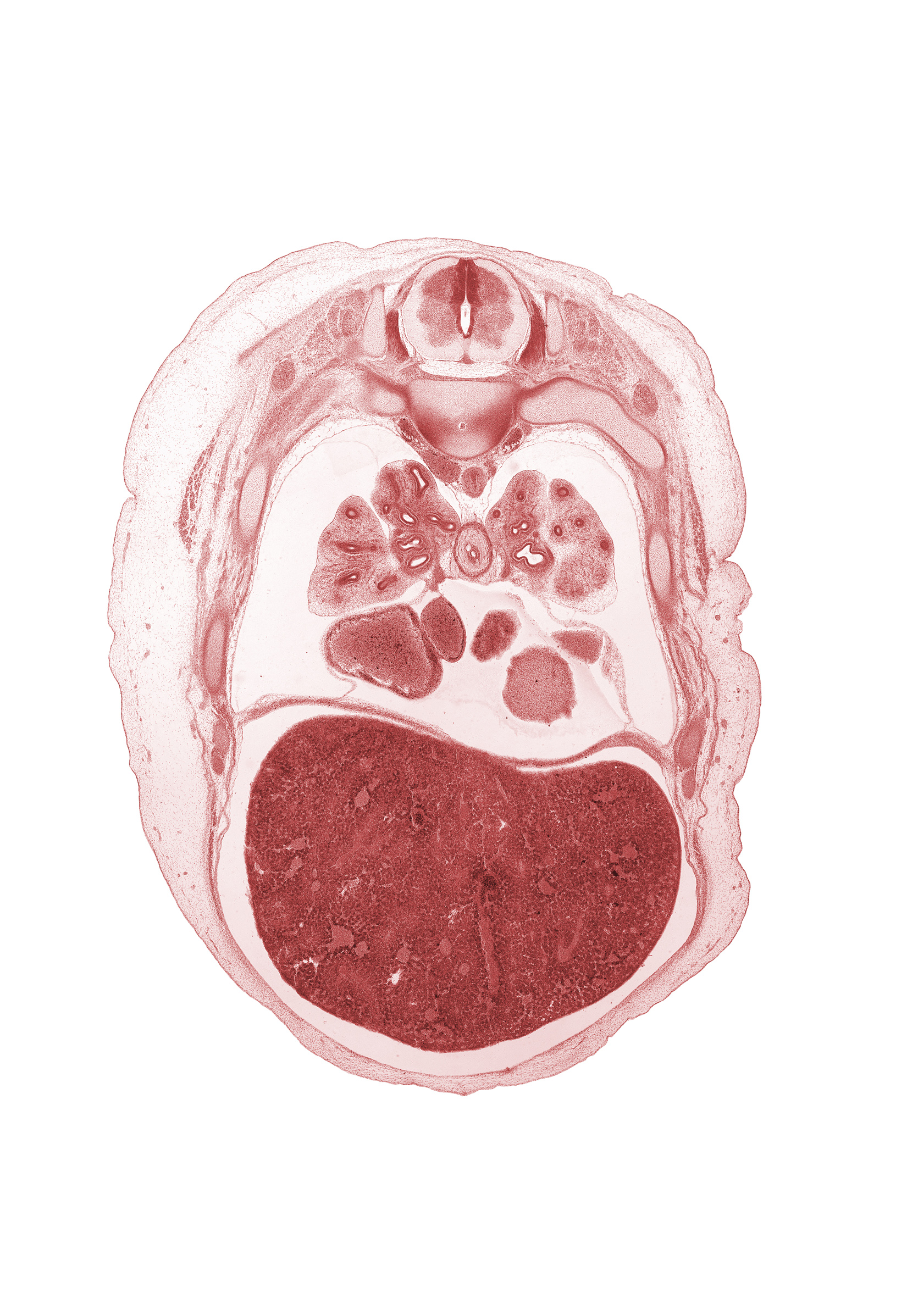 T-5 spinal ganglion, anterior basal segmental bronchus, caudal edge of left atrium, inferior vena cava, lateral basal segmental bronchus, left lobe of liver, left ventricle, lower lobe of left lung, lower lobe of right lung, medial basal segmental bronchus, middle lobe of right lung, oblique fissure, posterior basal segmental bronchus, rib 6, rib 7, right atrium, right lobe of liver, upper lobe of left lung