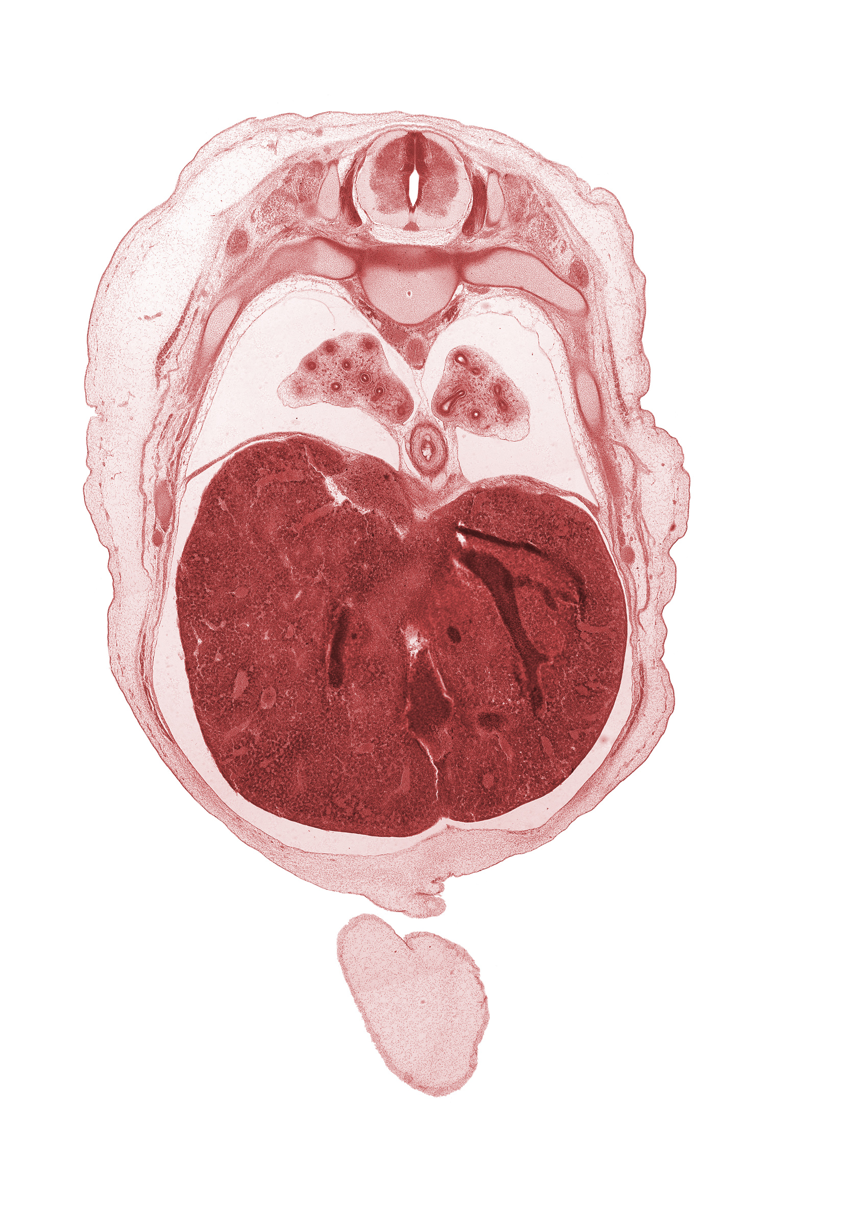 T-6 spinal ganglion, aorta, azygos vein, cephalic edge of umbilical cord, ductus venosus, efferent hepatic vein, inferior vena cava (hepatic part), liver prominence, lower lobe of left lung, lower lobe of right lung, muscular layer of esophagus, neural arch, osteogenic layer, rib 8, rib 9, subarachnoid space, surface ectoderm, sympathetic trunk