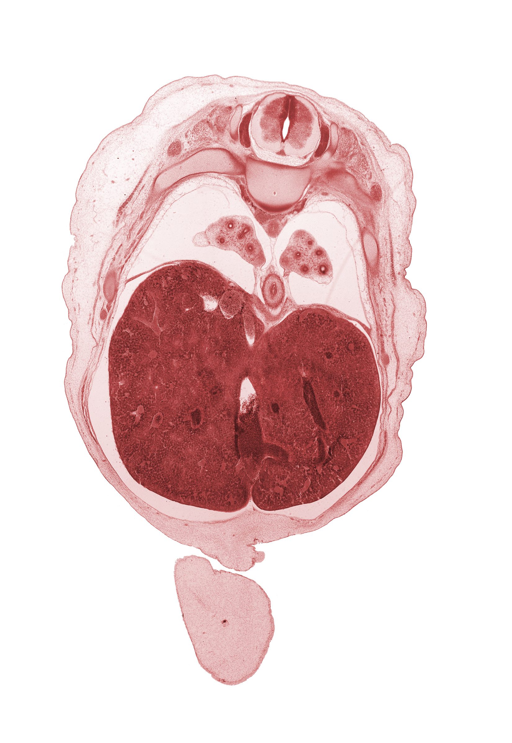 T-8 spinal ganglion, T-8 spinal nerve, afferent hepatic vein, anterior gastric nerve (CN X), diaphragm, ductus venosus, iliocostalis muscle, inferior vena cava (hepatic part), junction of ductus venosus and inferior vena cava, latissimus dorsi muscle, left lobe of liver, longissimus muscle, lower lobe of left lung, lower lobe of right lung, muscular layer of esophagus, pleural recess, posterior gastric nerve (CN X), rib 9, right lobe of liver, spinalis muscle, umbilical cord