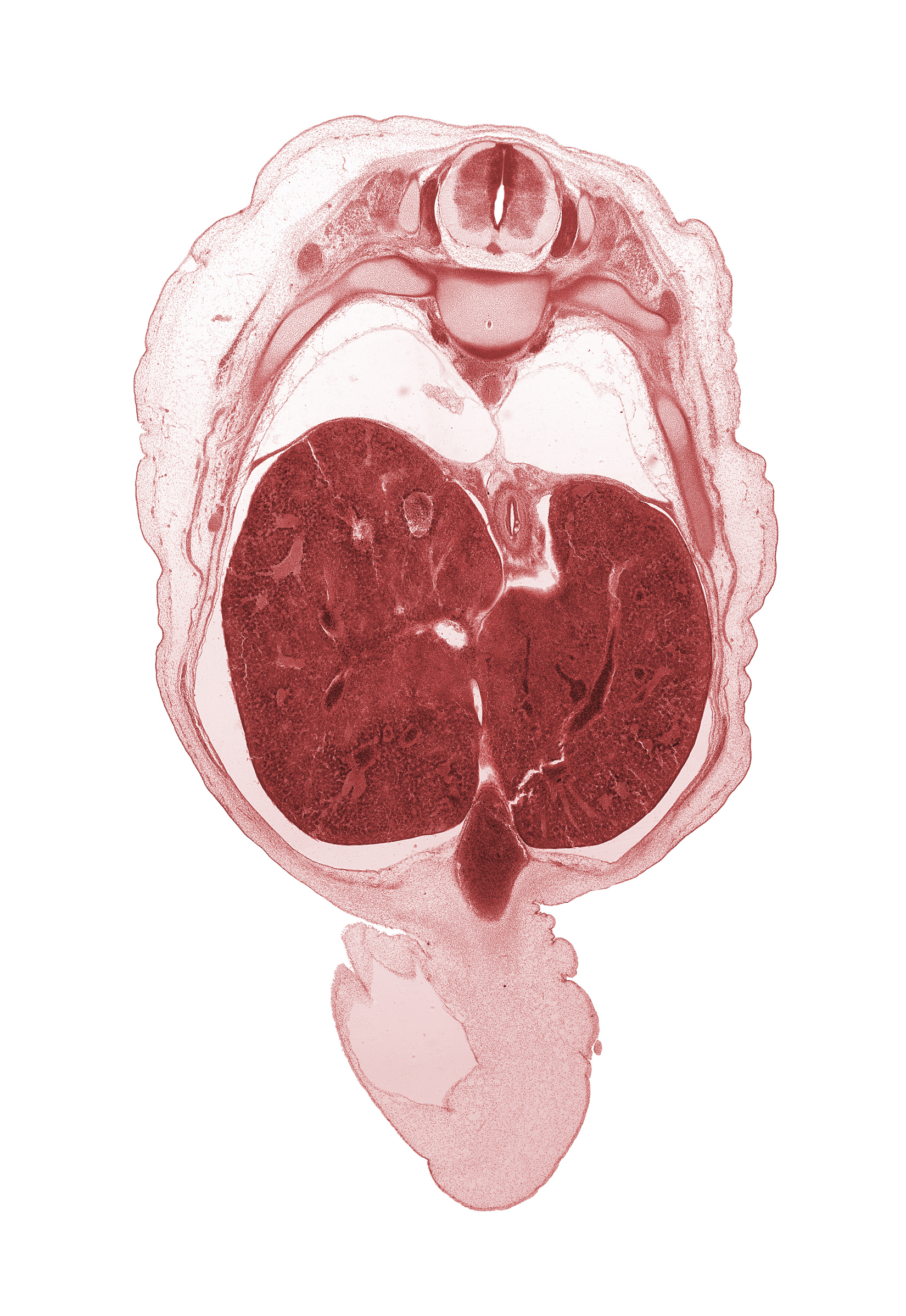 T-9 spinal ganglion, T-9 spinal nerve, amnion on surface of umbilical cord, aorta, azygos vein, dorsal meso-esophagus, esophagus, hepatic portal vein, iliocostalis muscle, inferior vena cava (hepatic part), left lobe of liver, longissimus muscle, lung, right, rib 10, rib 9, right lobe of liver, spinalis muscle, sympathetic trunk, umbilical coelom, umbilical vein